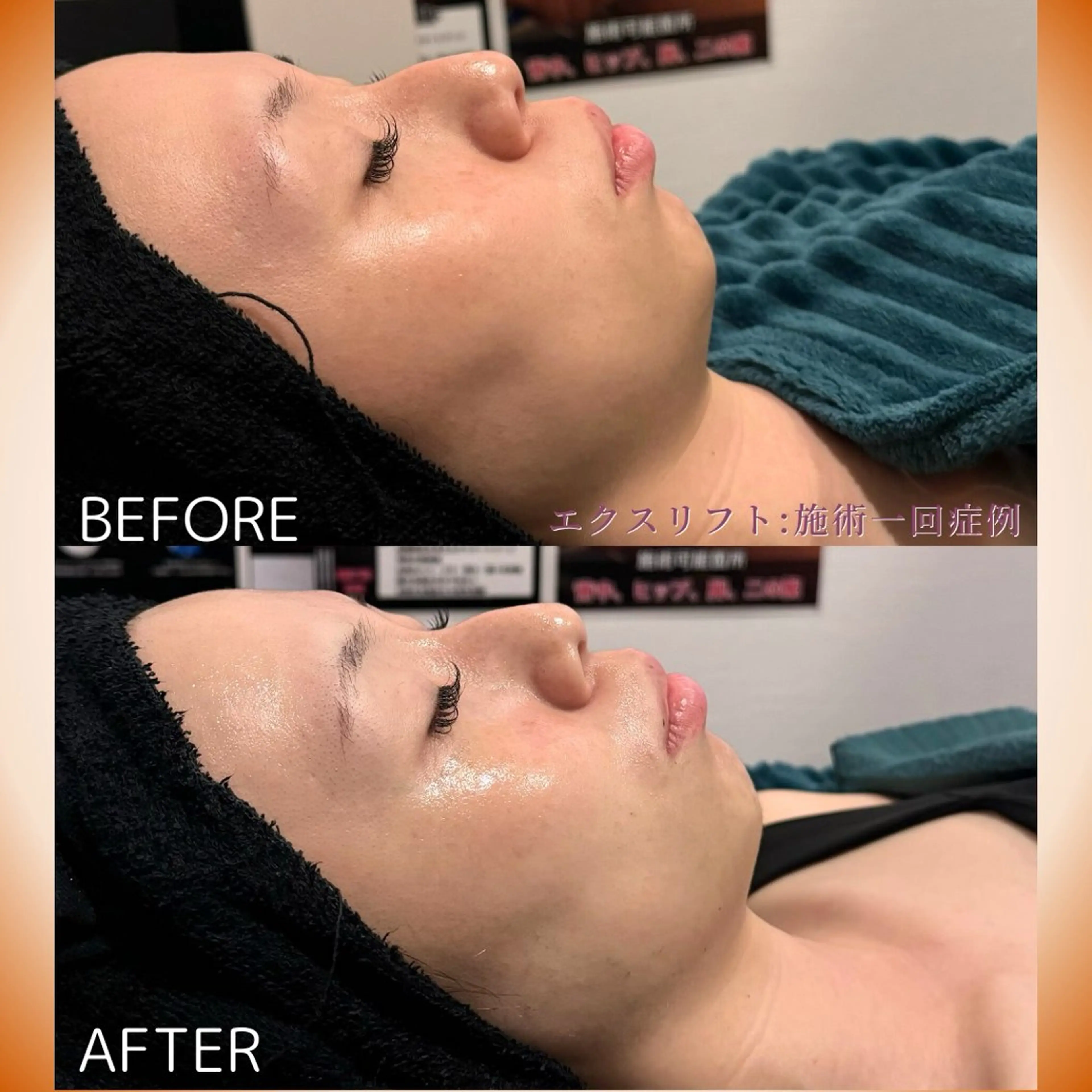 その他 NANIOAFU [なんば店］のその他イメージ