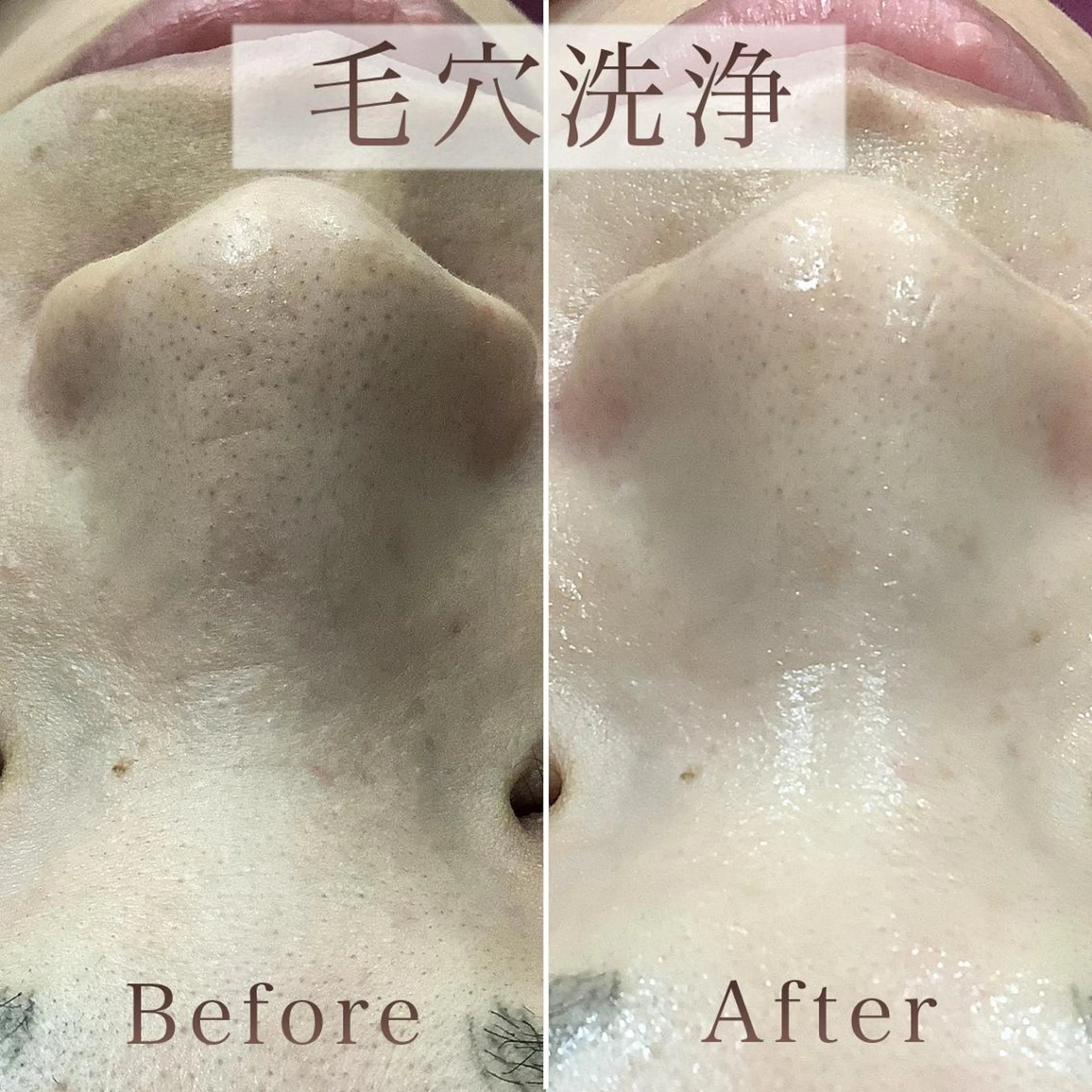 エステ リラク 【毛穴洗浄・小顔】 セラピスト　和田紋子のエステ・リラクイメージ