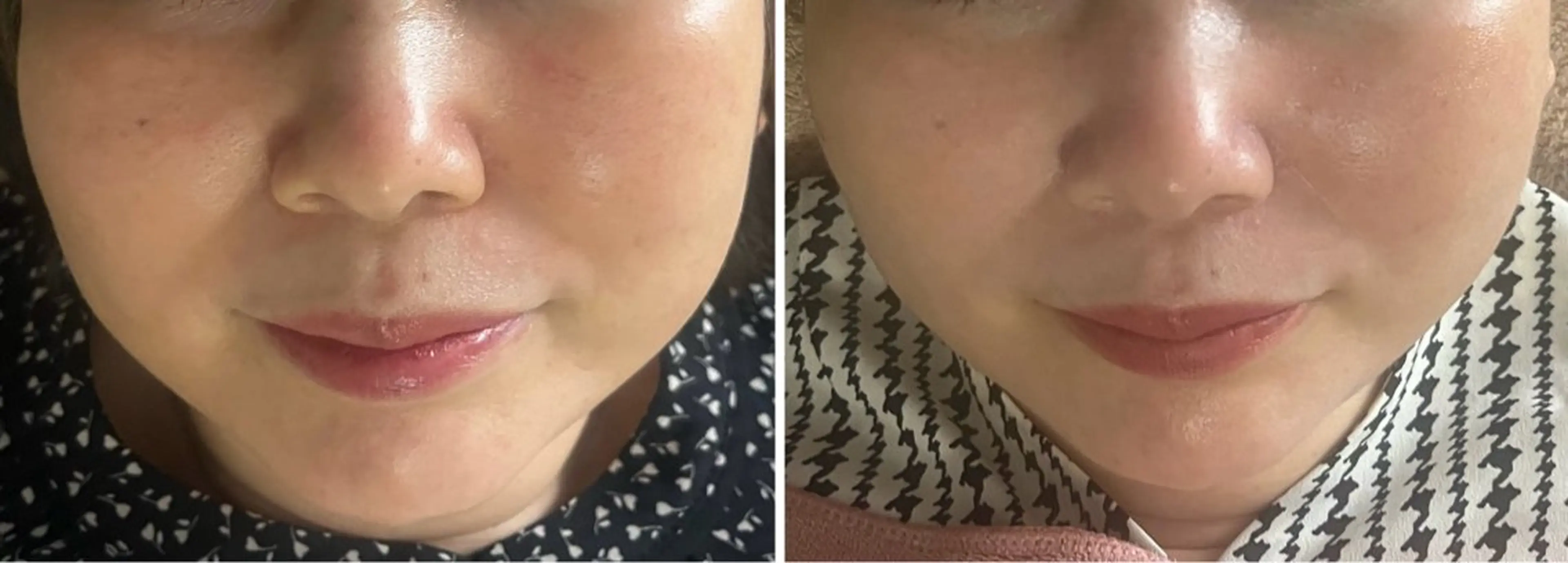 エステ アロマ･美容鍼･カッ ピング「麗」鍼灸院のエステ・リラクイメージ