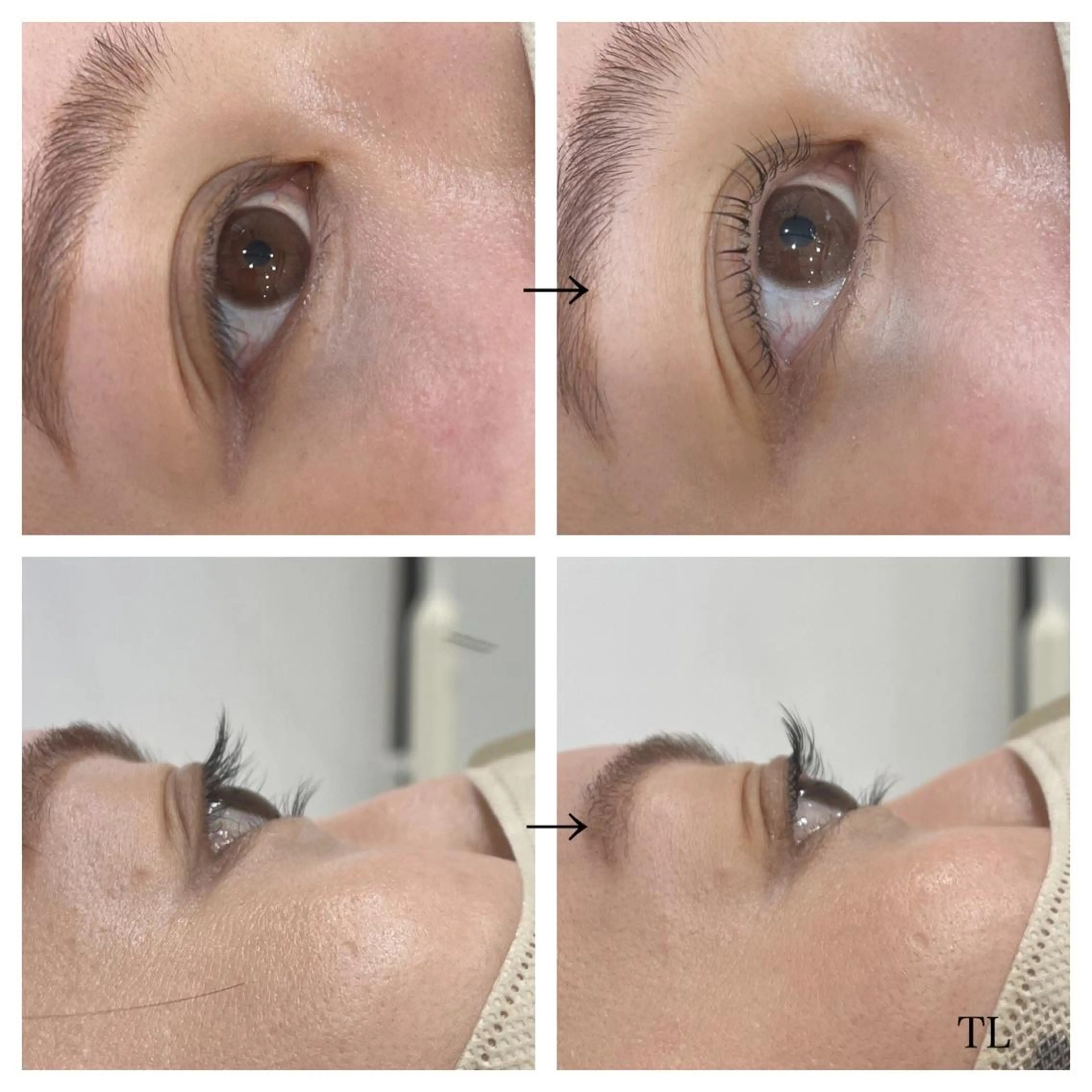 マツエク・マツパ ビューティー ミロワールのエステ・リラクイメージ