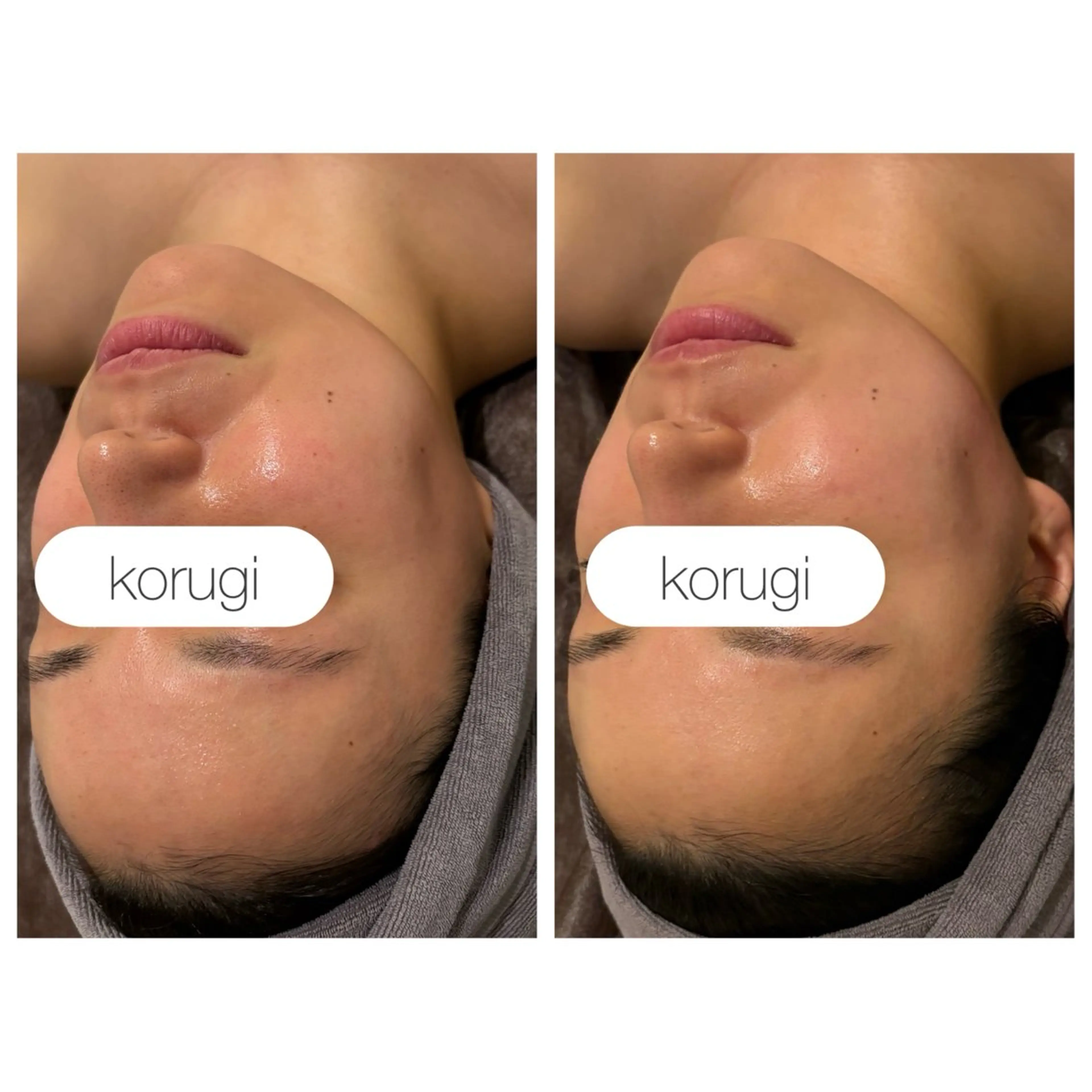 小顔コルギ ☆表参道/外苑前のエステ・リラクイメージ