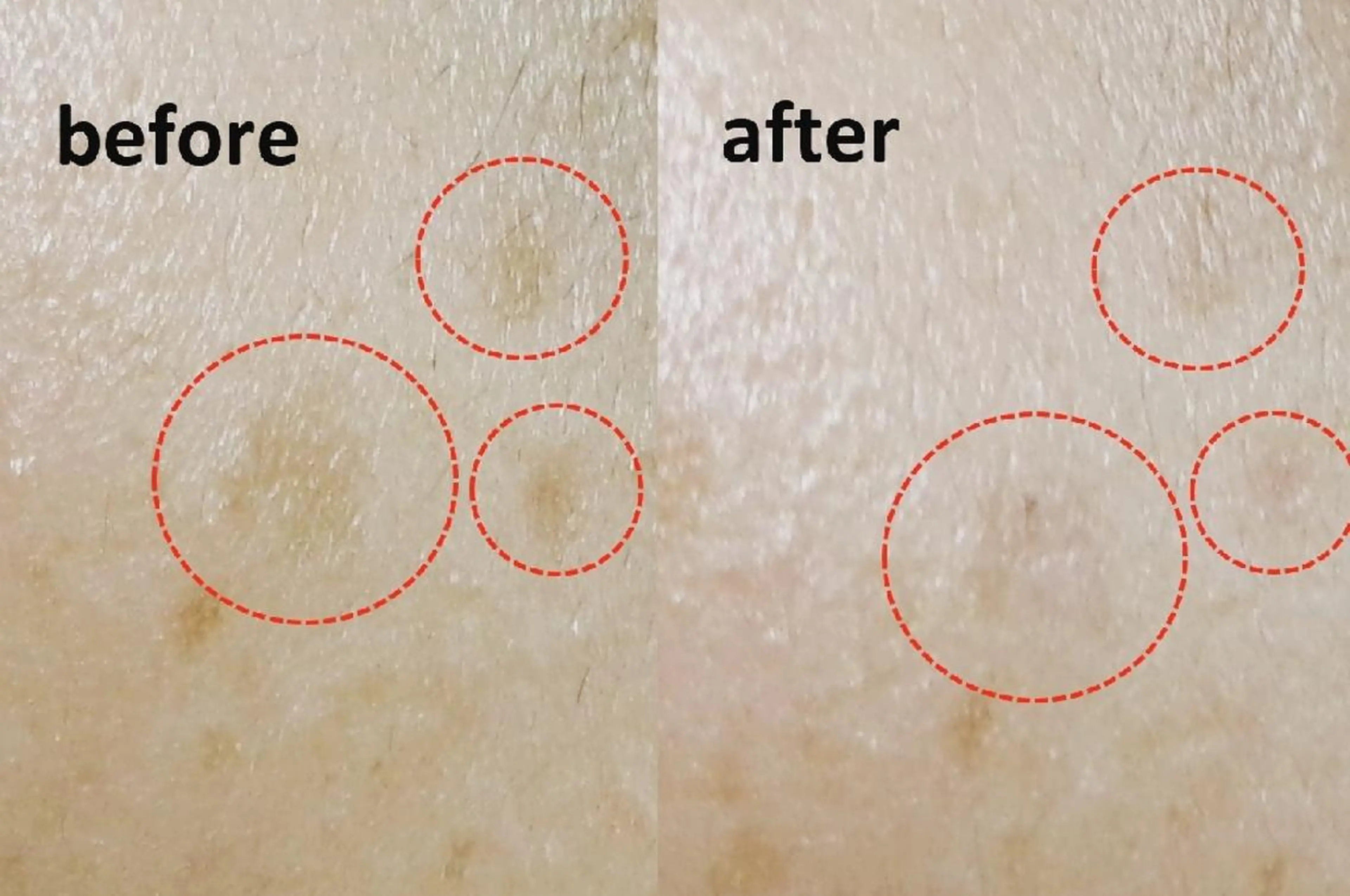 エステ  lafraise 田邉 里香のエステ・リラクイメージ