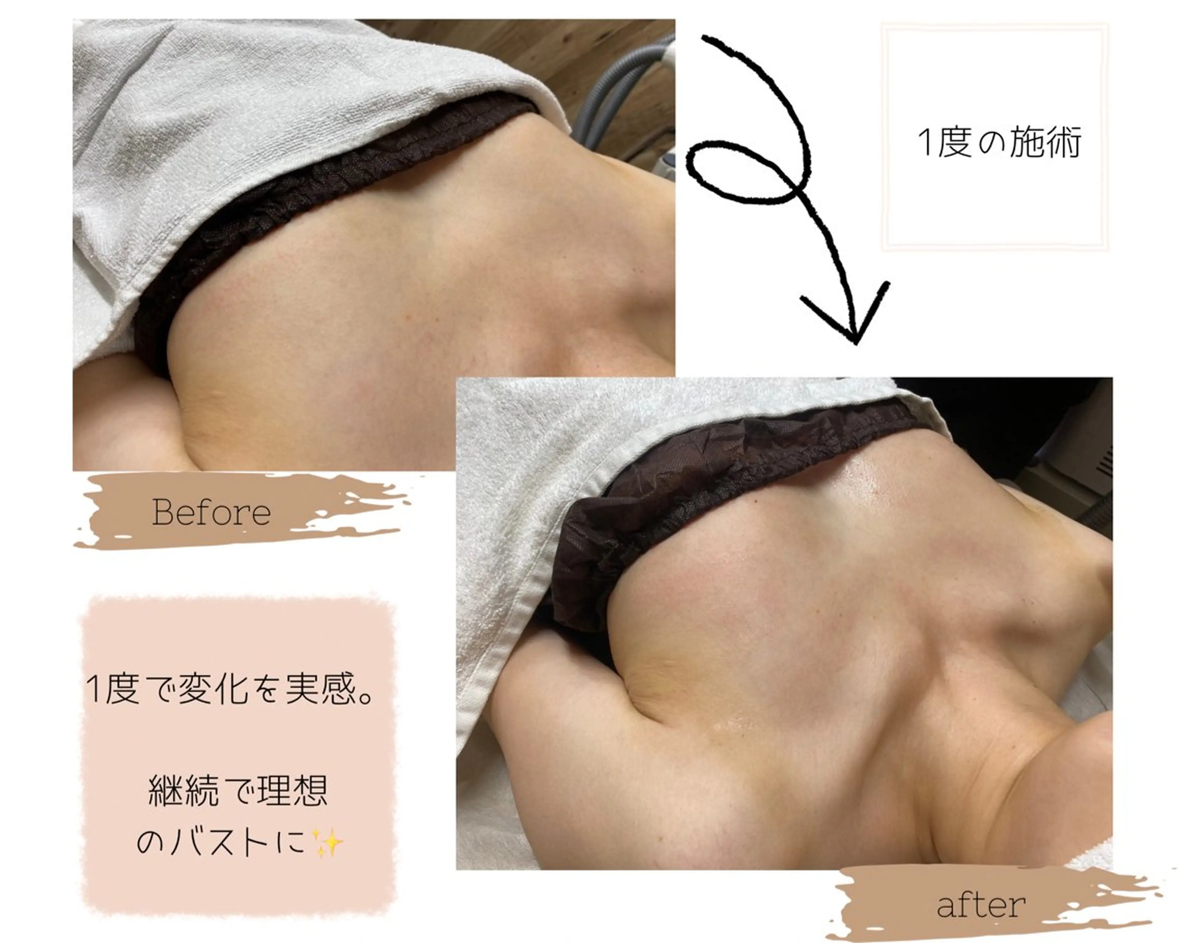 minimo限定 【女性の永遠のテーマ】バストアップケア 初回¥5000⭐️の写真