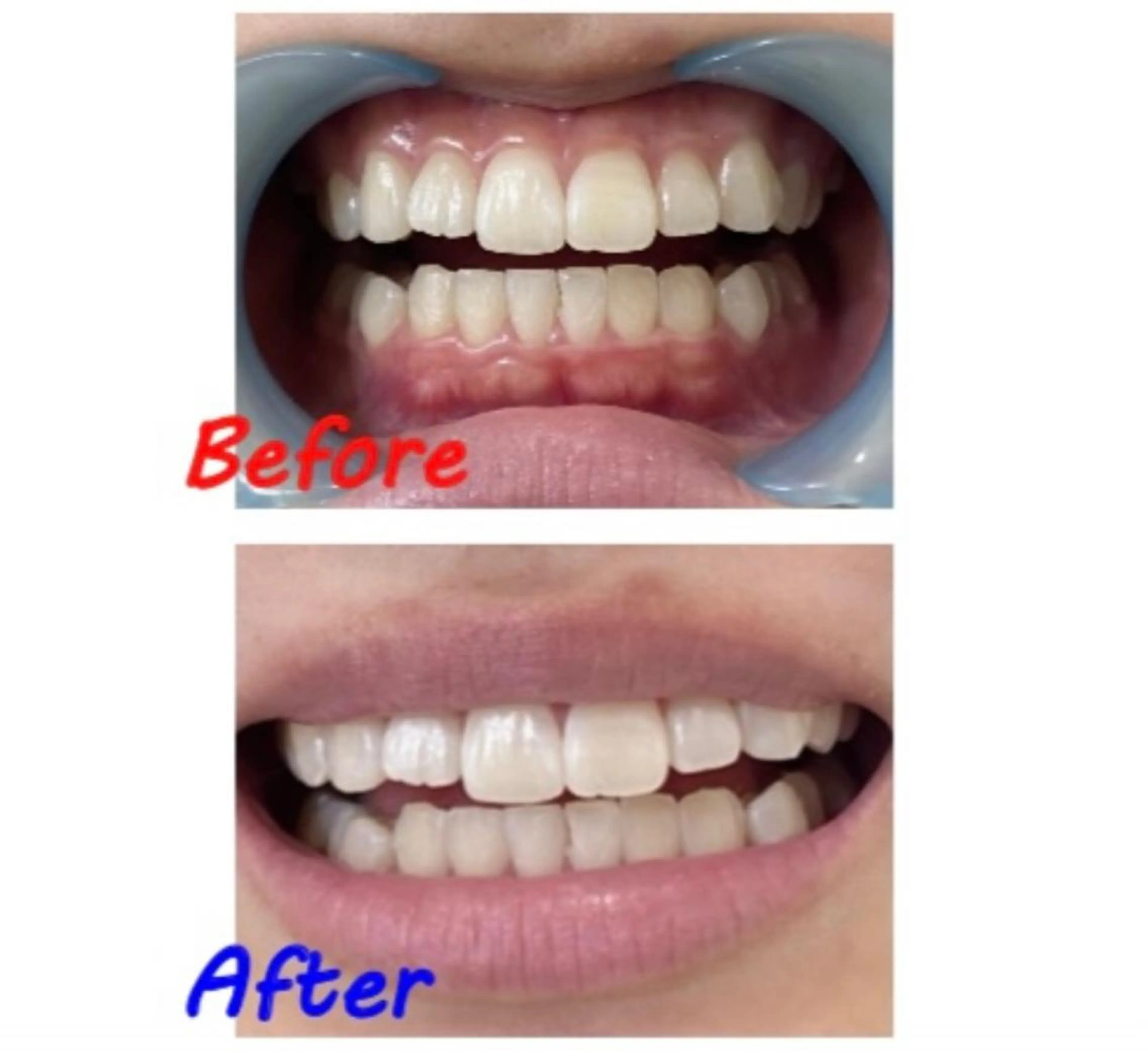 その他 ホワイトニングサロン La vie enのその他イメージ