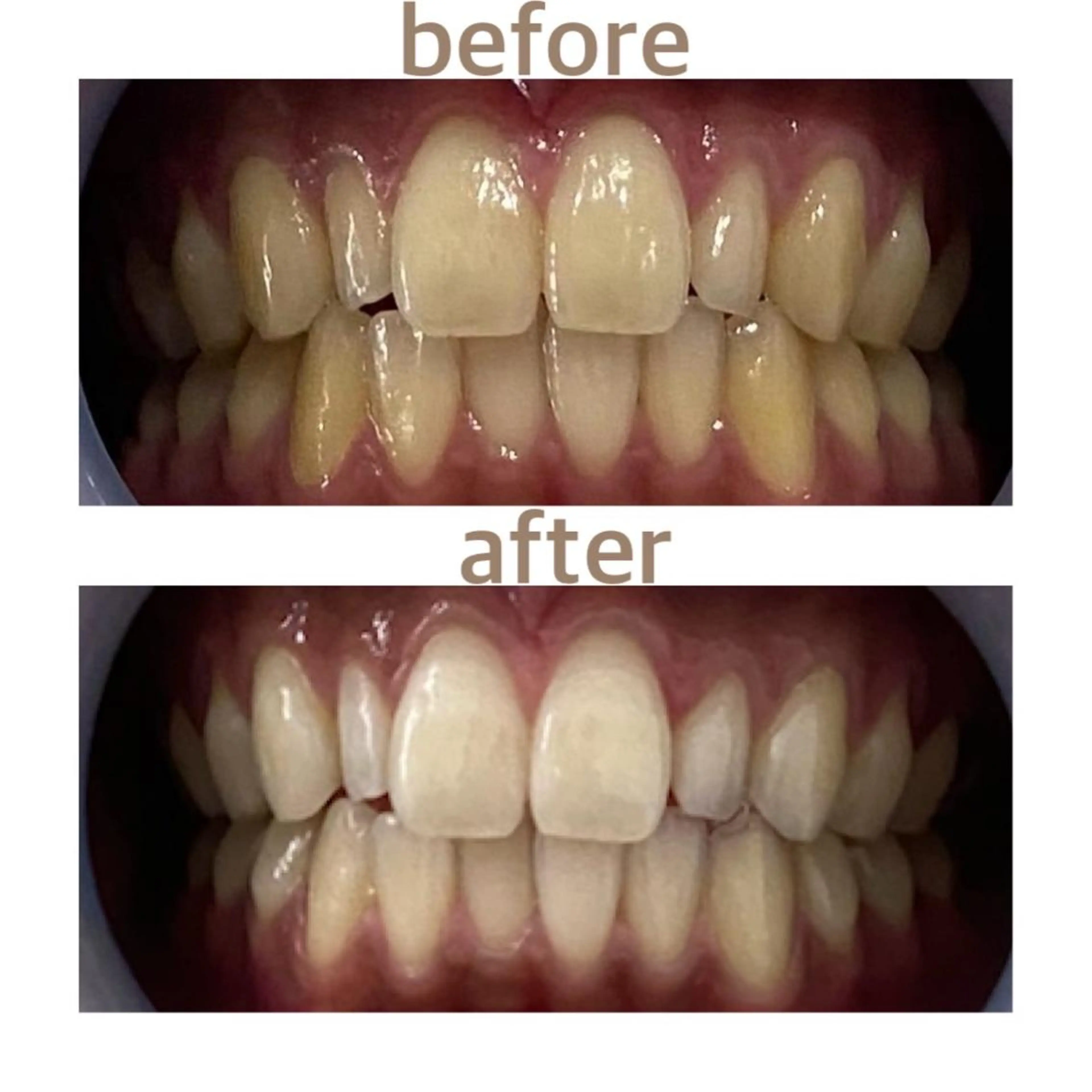 メンズ その他 ホワイトニング ショップ本八幡店のエステ・リラクイメージ