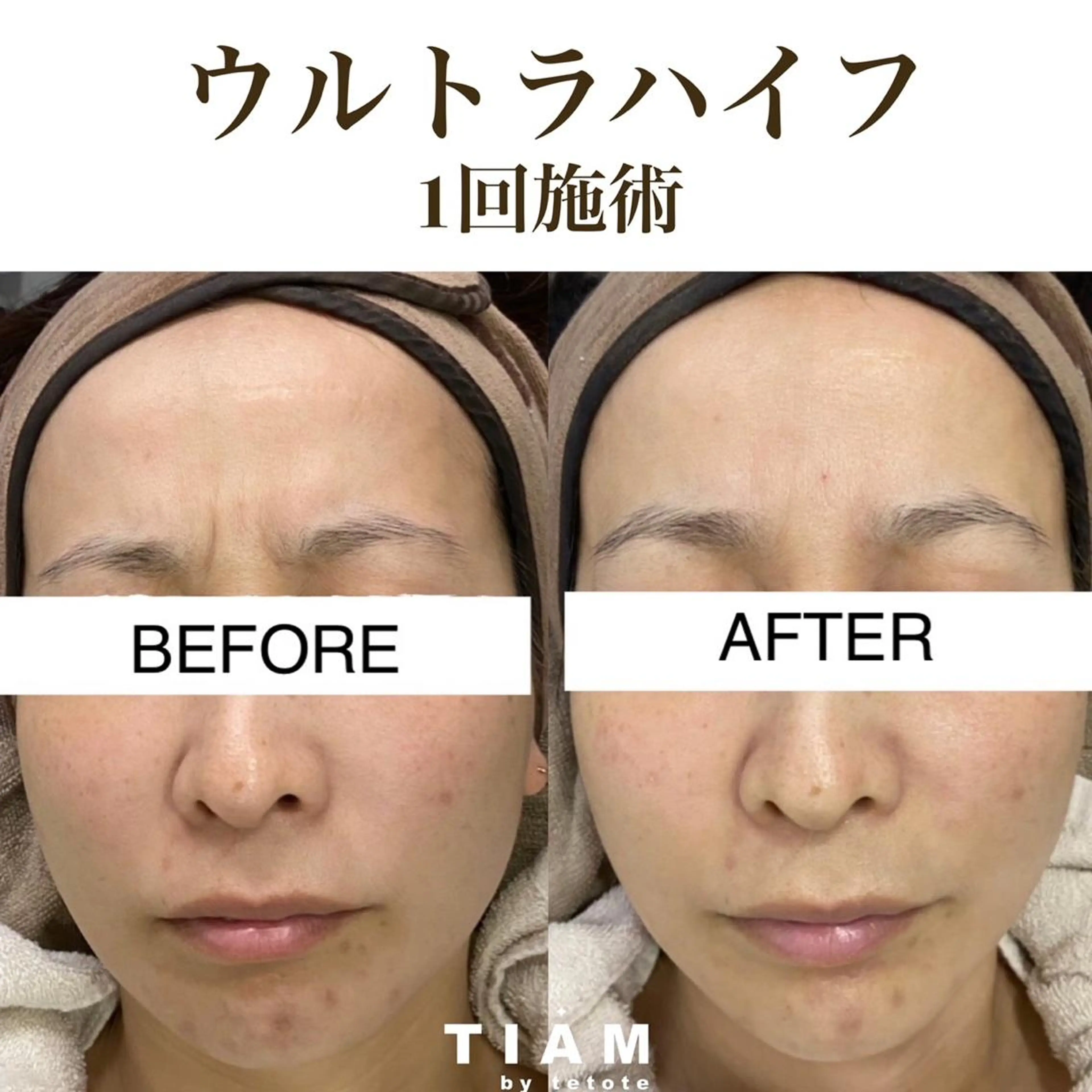 美肌サロンTIAM by tetoteのエステ・リラクイメージ