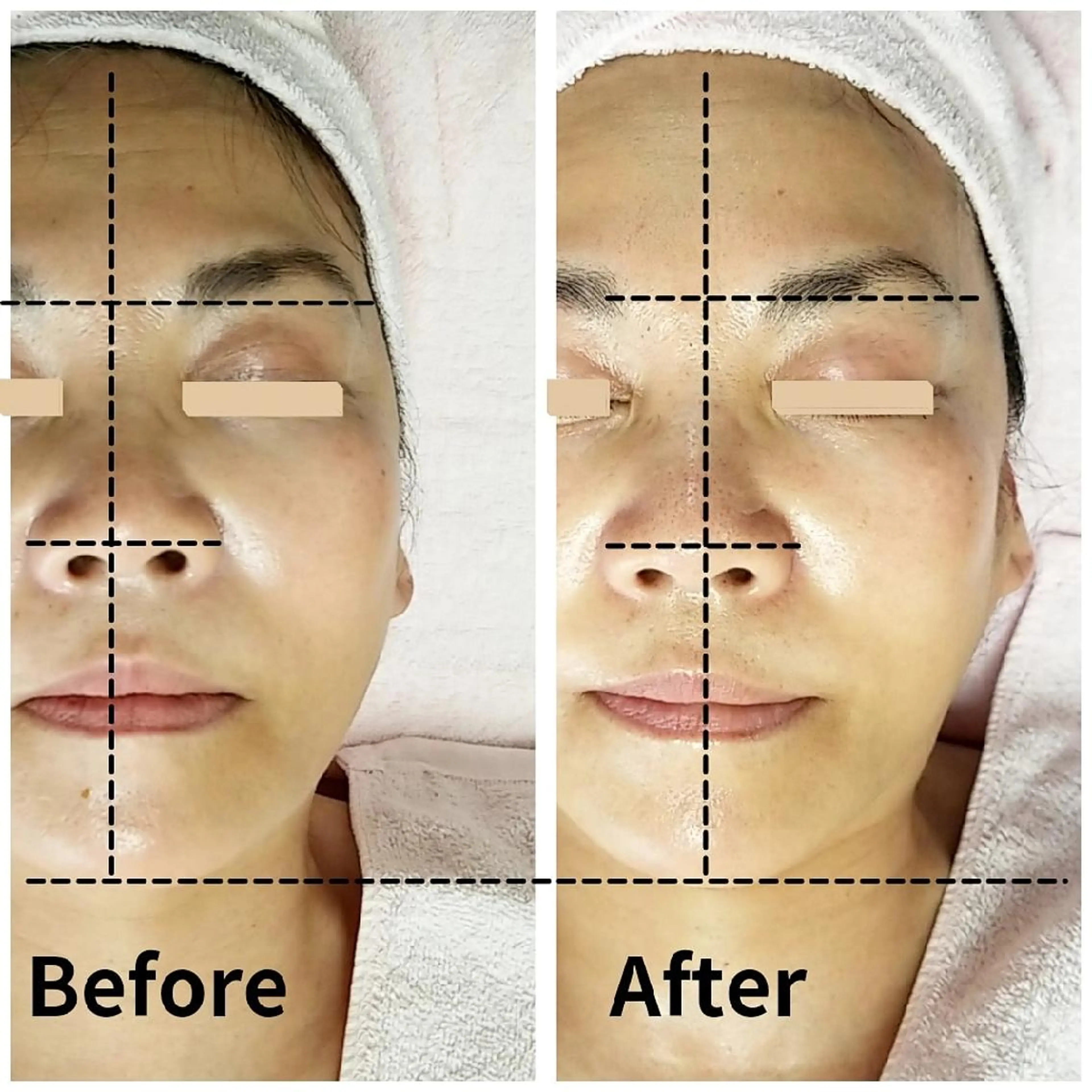 自然派フェイシャル やながわのエステ・リラクイメージ