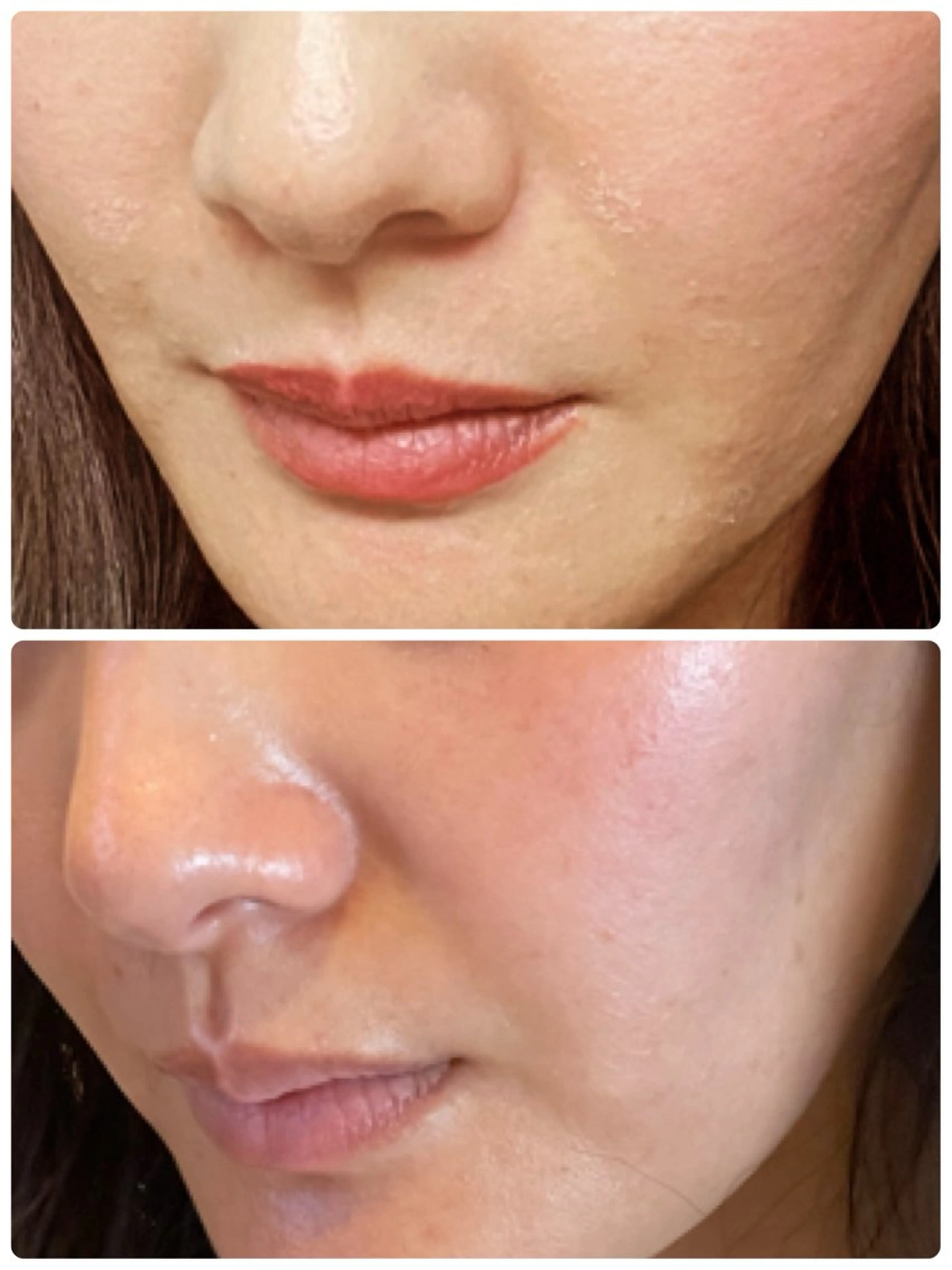 Luce所属・Luce Shokoのエステ・リラクイメージ