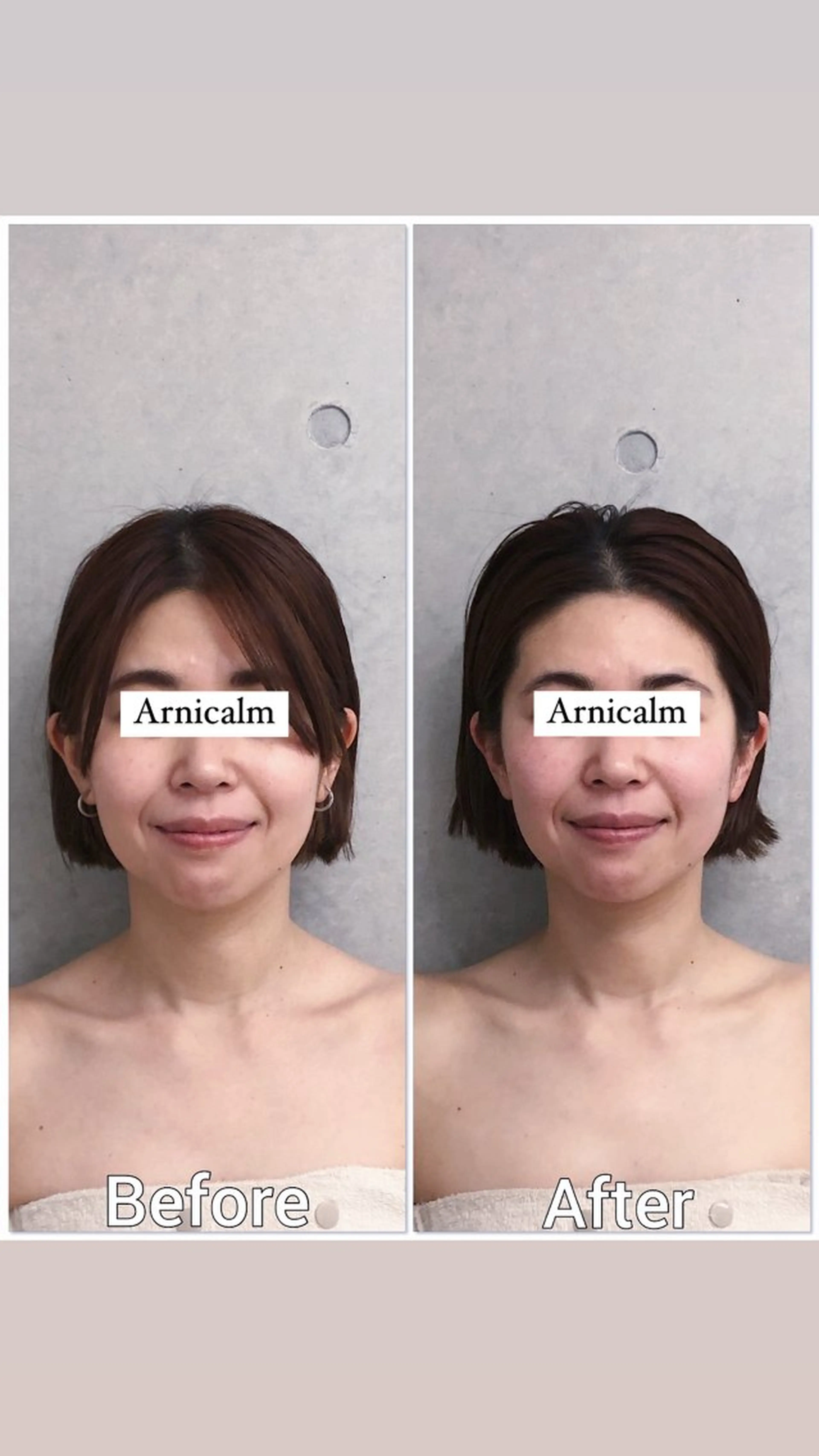 ハーブピーリング 肌再生ピーリング/のエステ・リラクイメージ