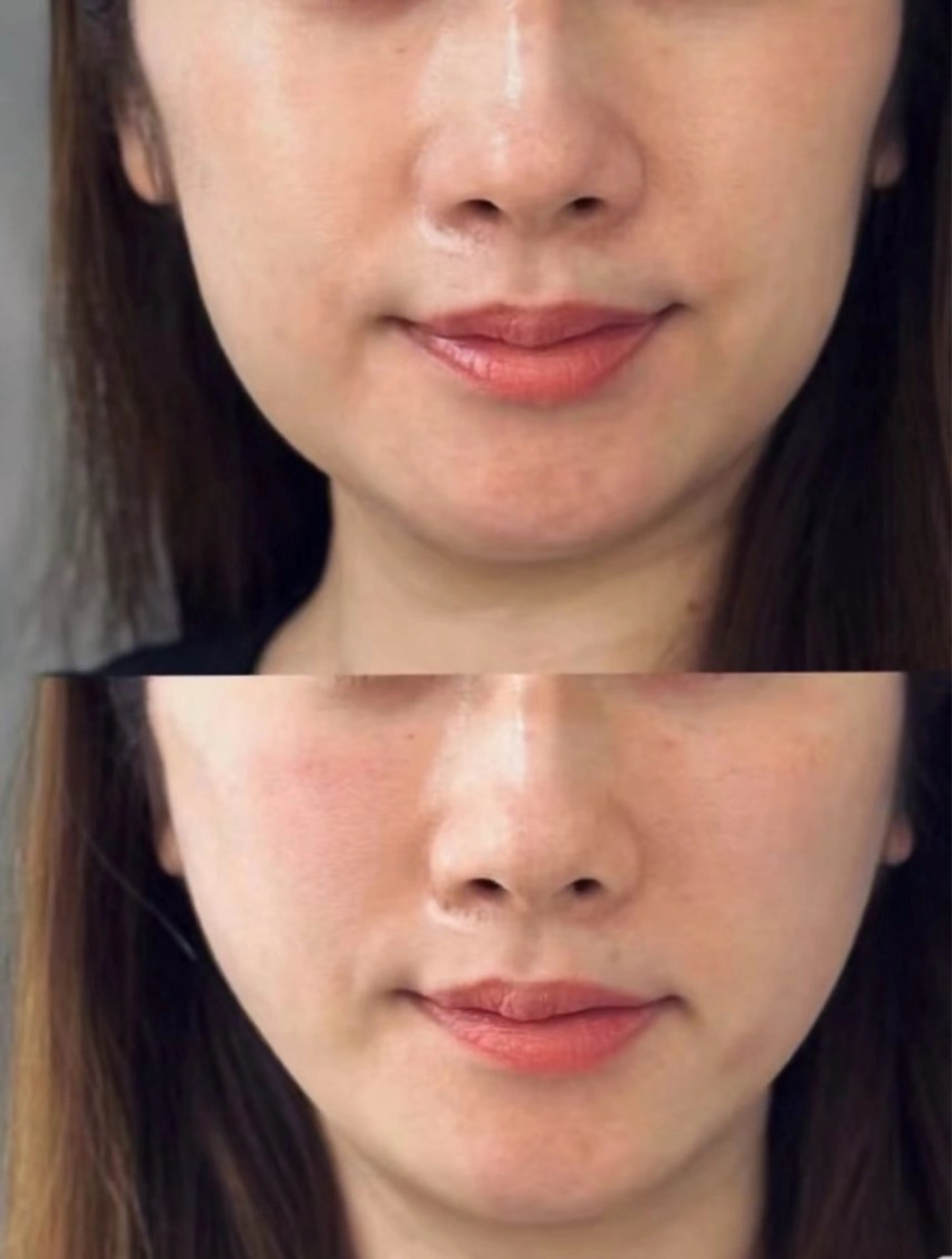 マツエク・マツパ エステ リラク aliaハーブ水光店 エステティシャン募集のエステ・リラクイメージ