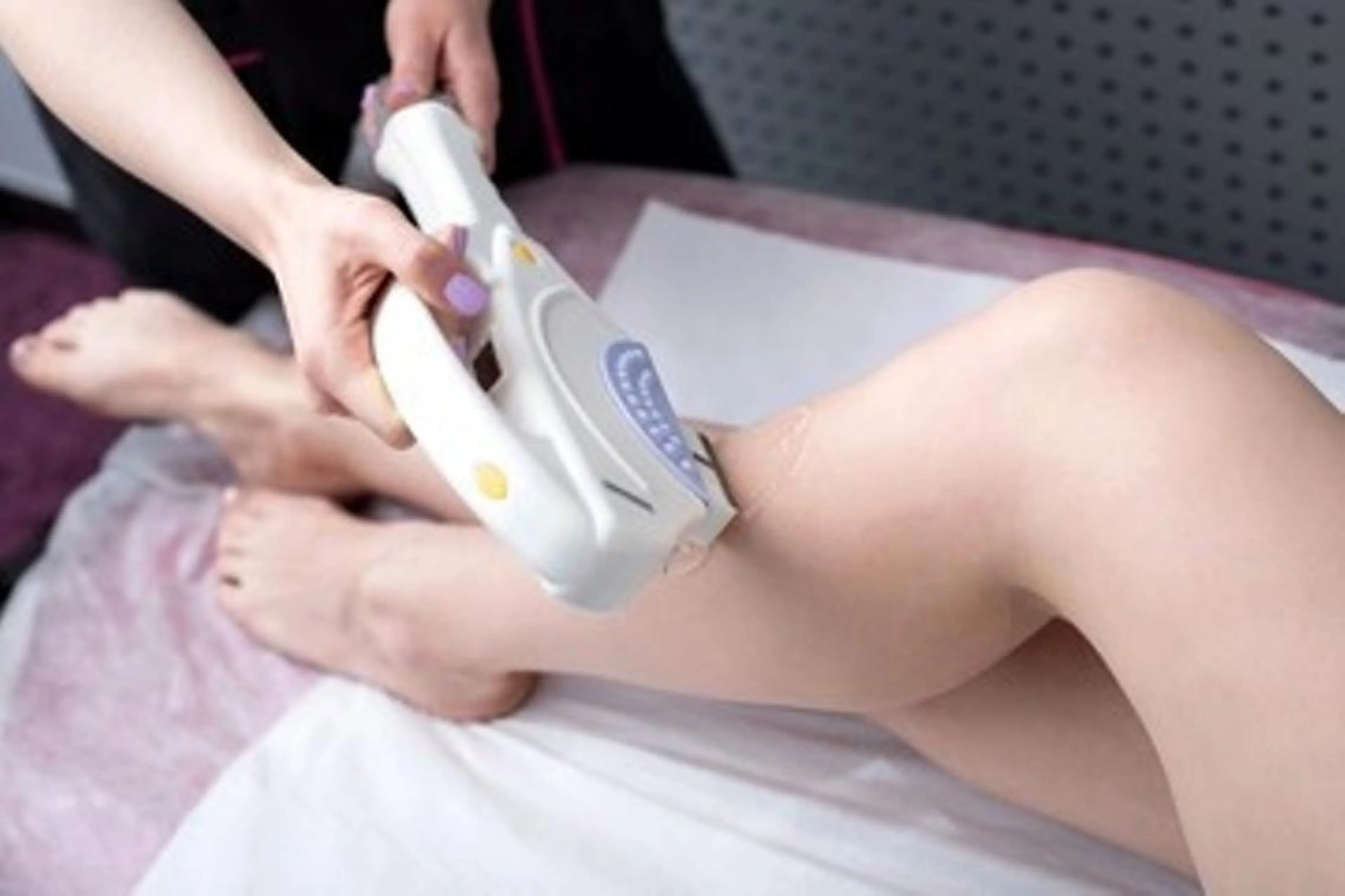 初回限定 モテ男の脱毛(腕・脚・ワキSET) ルミクスSHR脱毛の写真