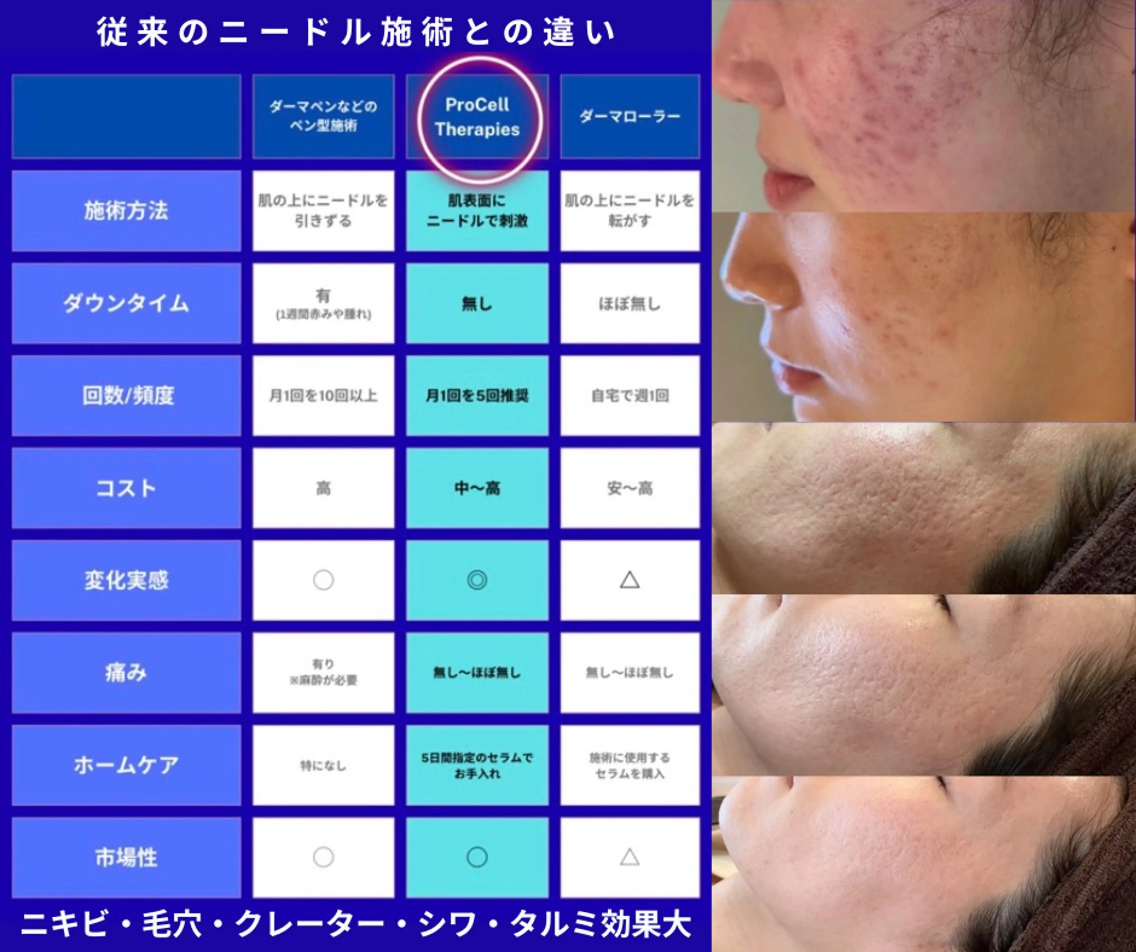 【2月新スタート】たるみ毛穴凹凸肌を土台～バイオ成長因子速攻肌ケア トリートメント  3回/5回コース契約ありの写真