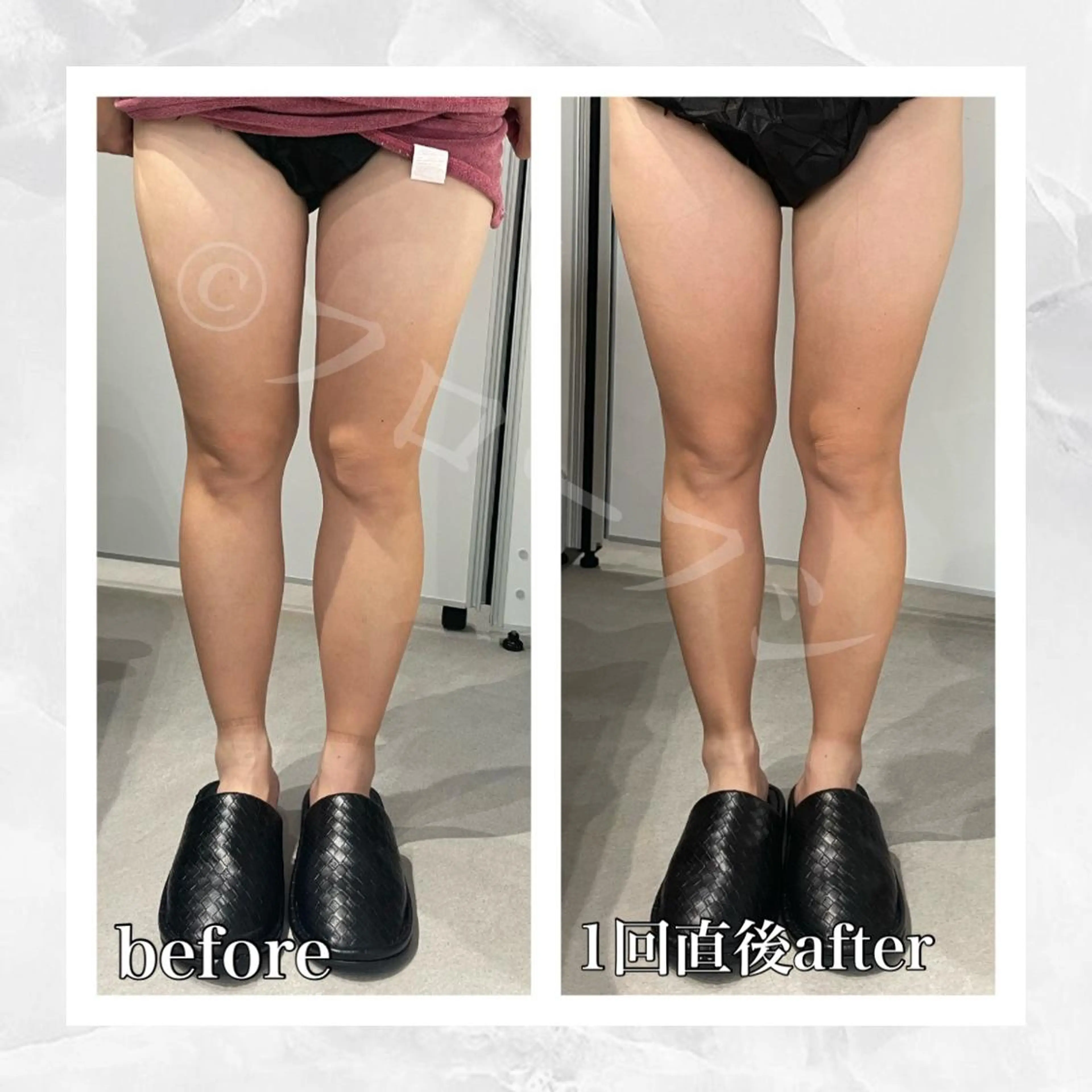 エステ リラク 部分痩せ♥️小顔専門 MIKUのエステ・リラクイメージ