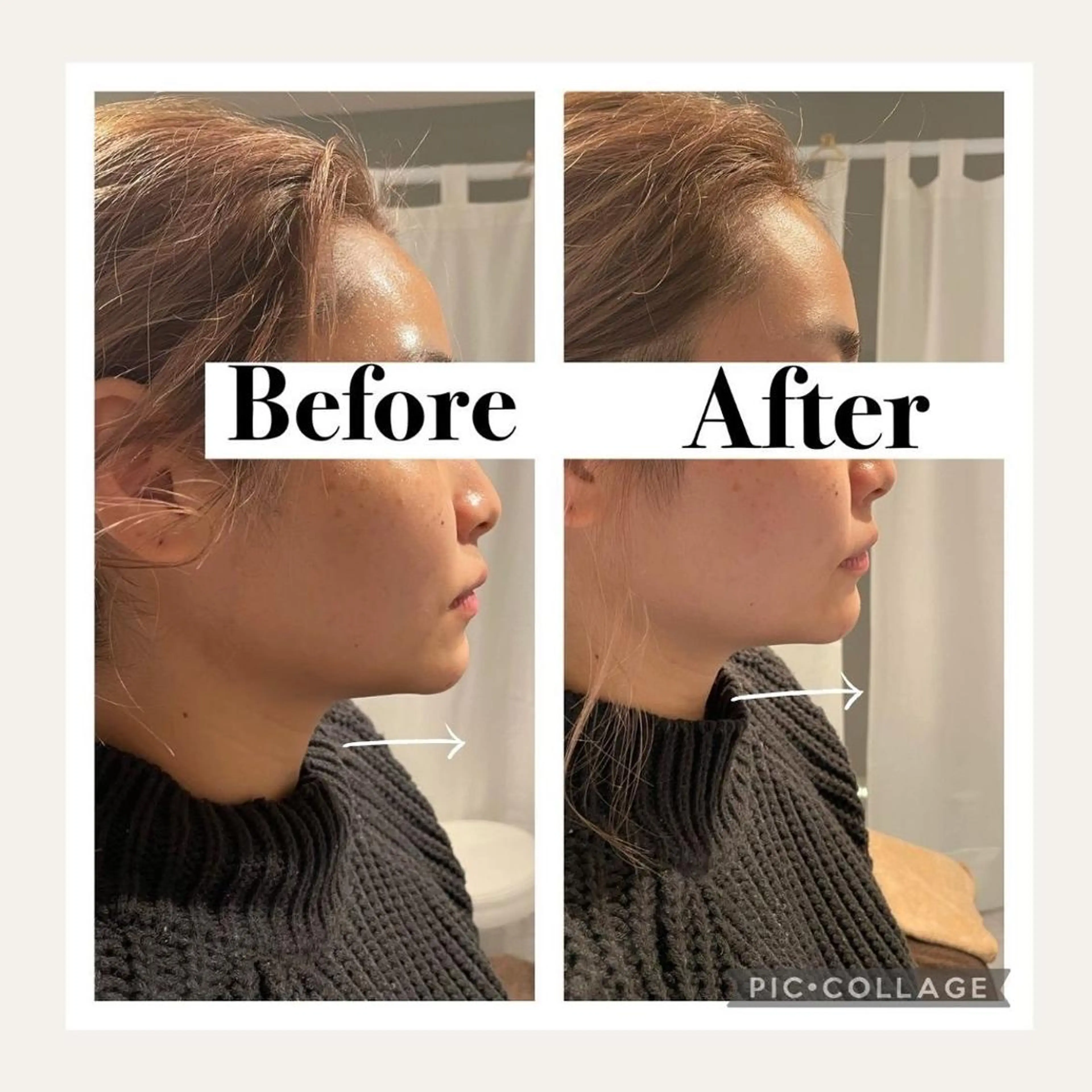 12Dハイフ💗 最強小顔のエステ・リラクイメージ