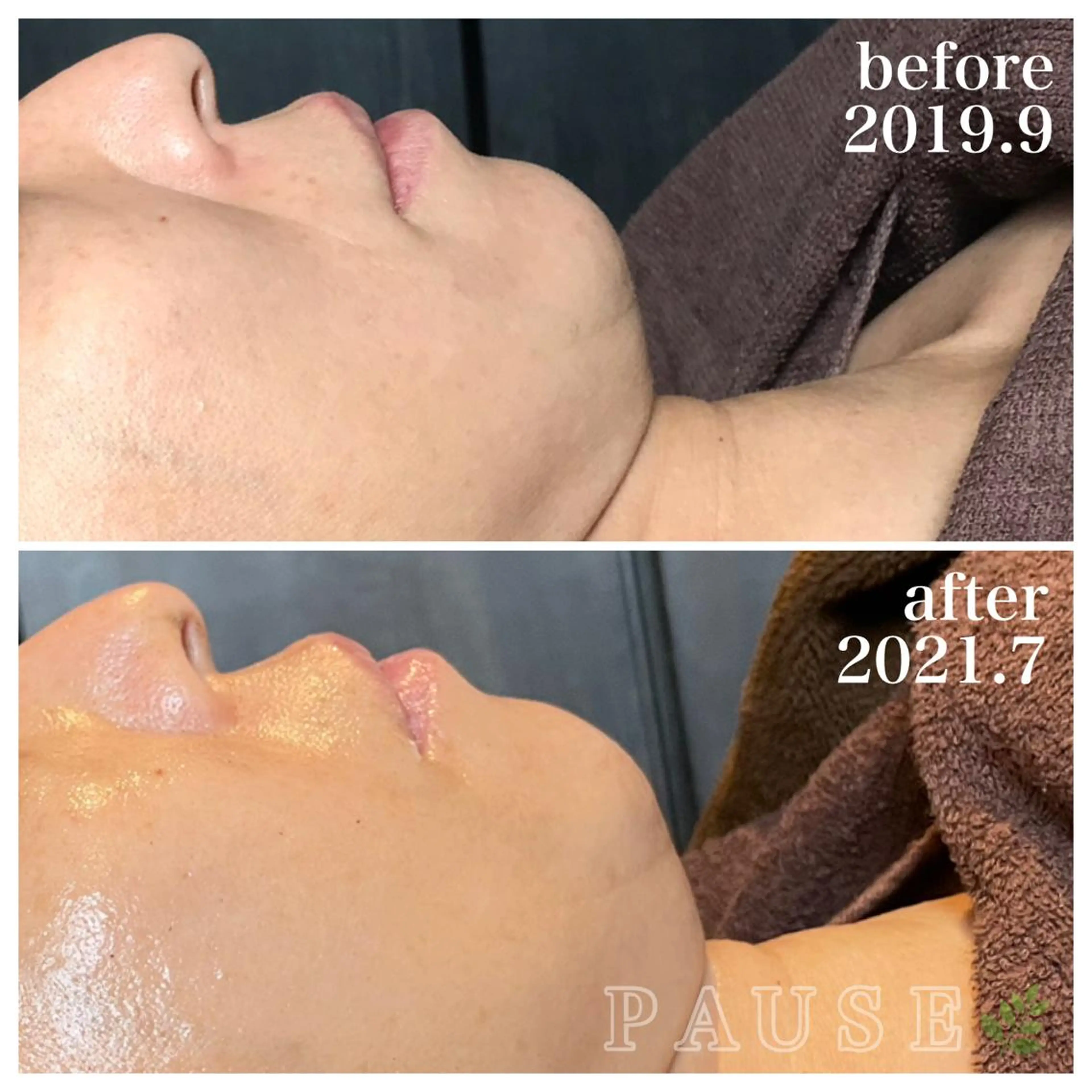 エステ 浜野 恵美のエステ・リラクイメージ