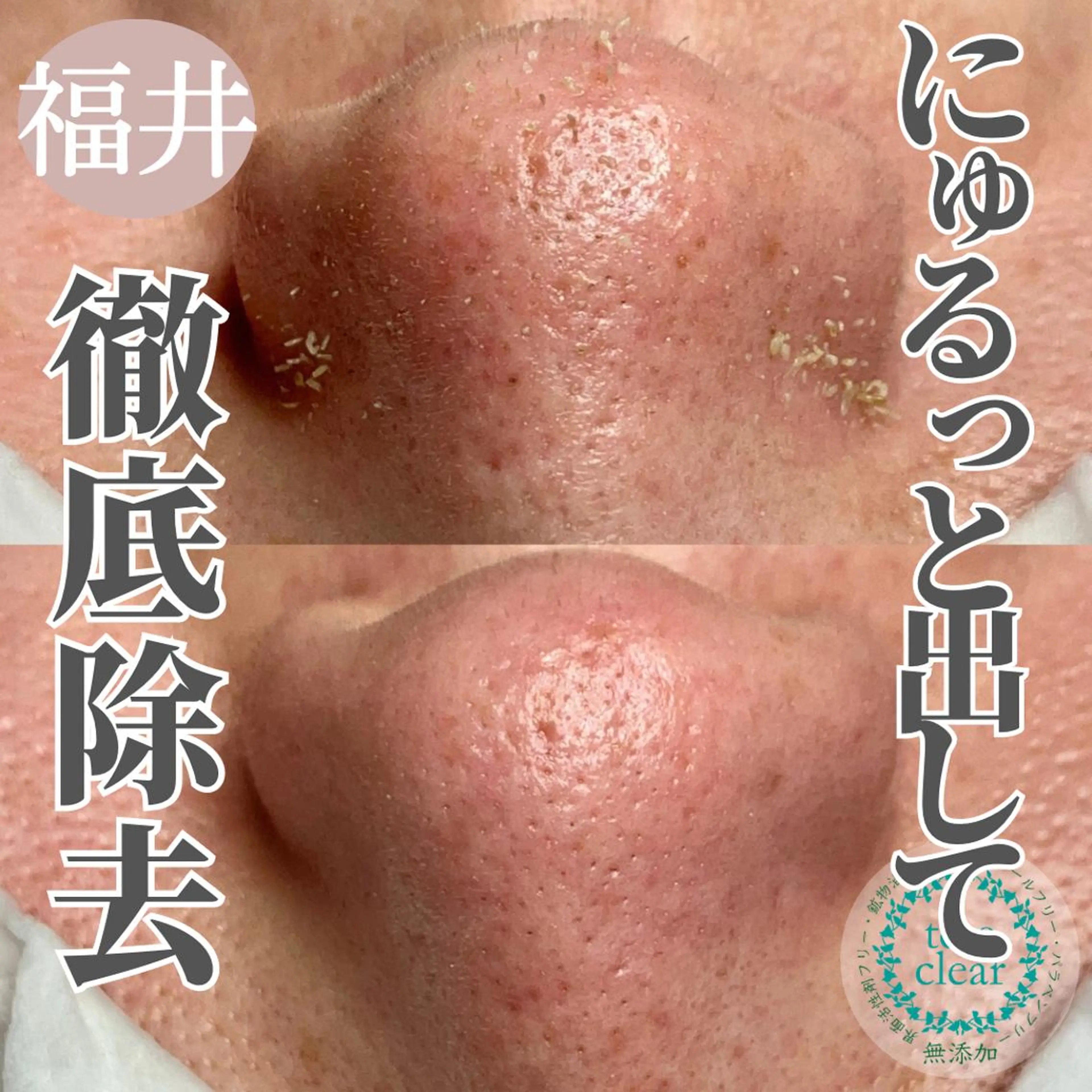 毛穴肌質ケアサロン Yourmeユアミーのエステ・リラクイメージ