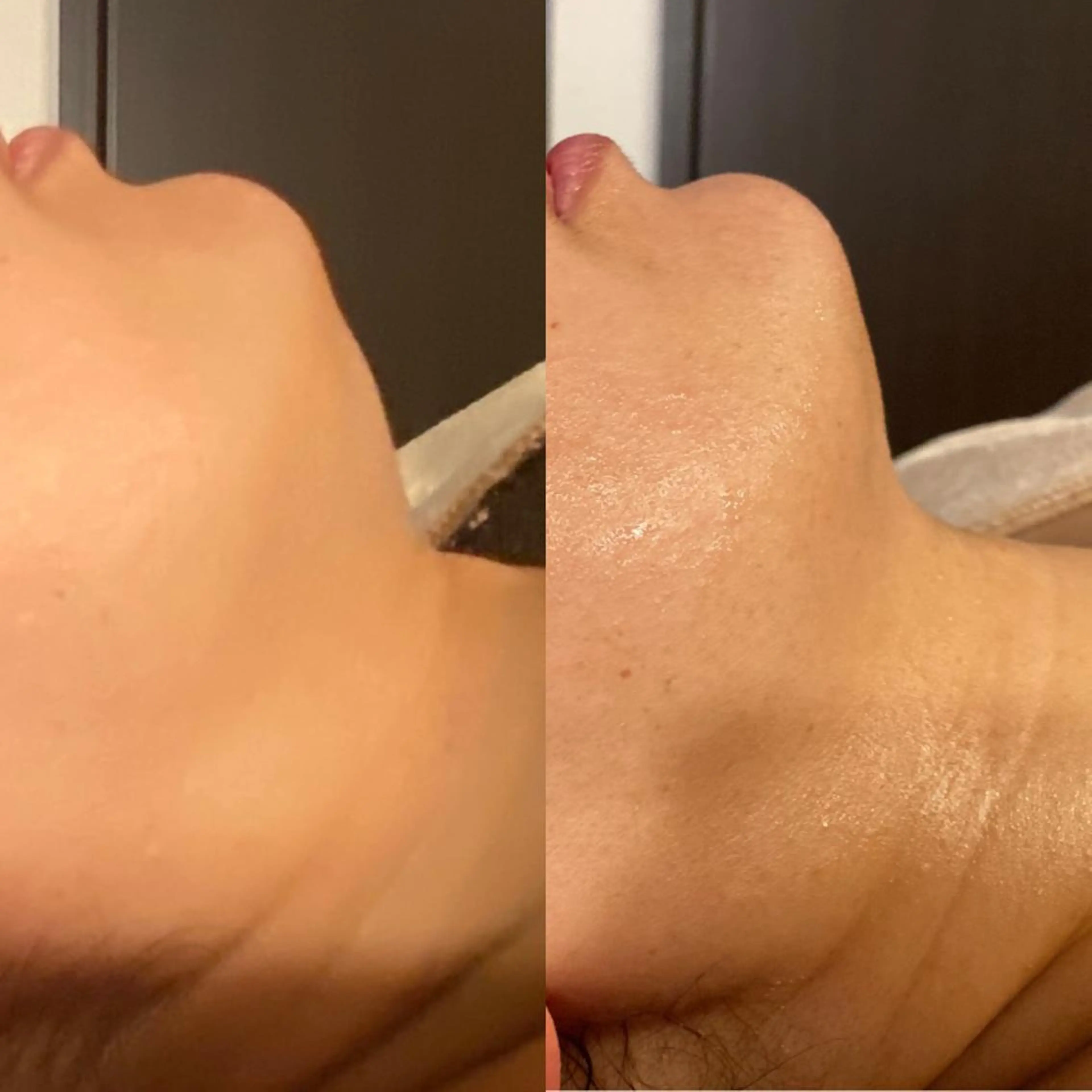 Mandarin Orange所属・毛穴から始める肌メン テマンダリンオレンジのエステ・リラクイメージ