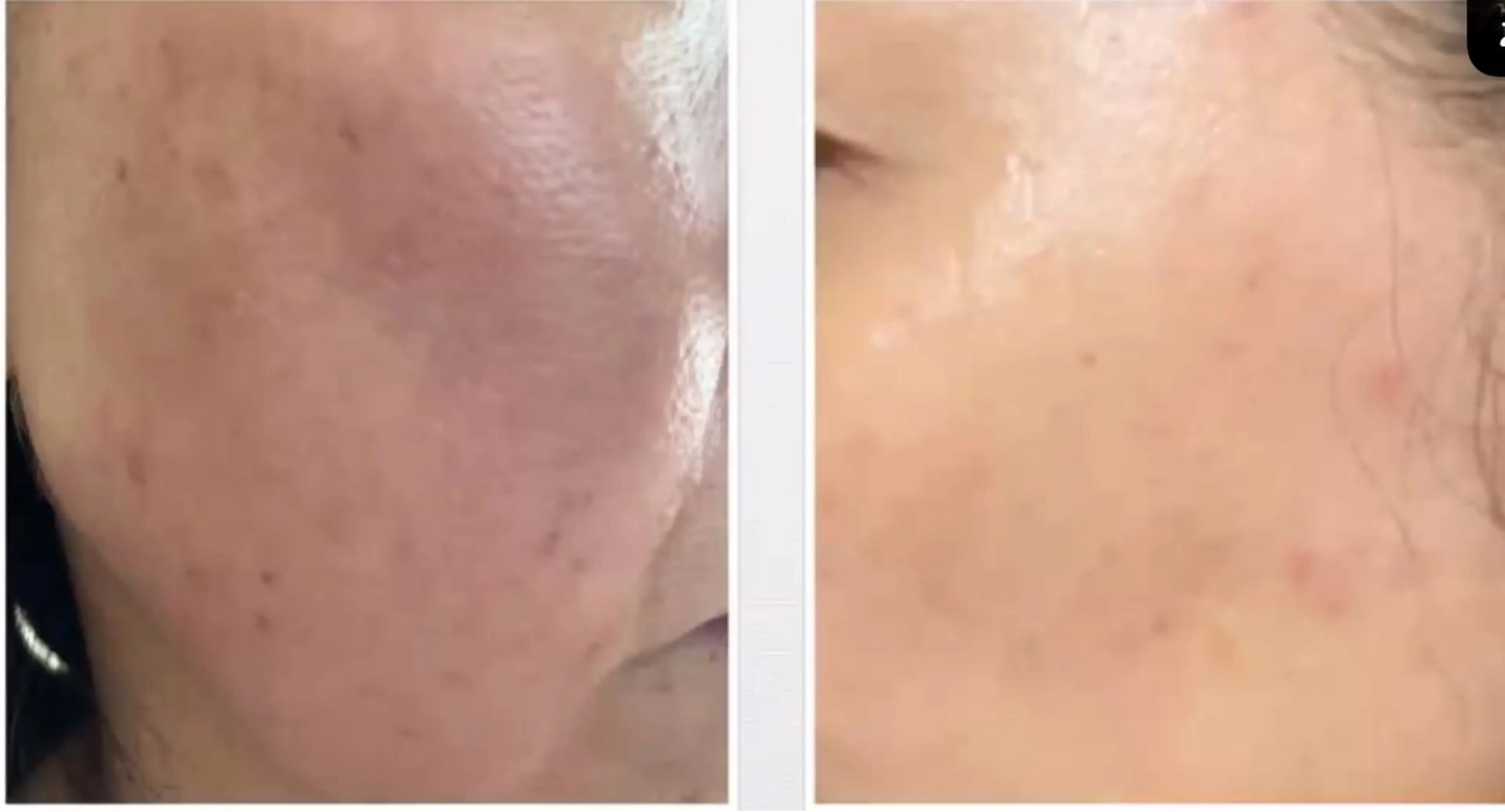 エステ 古川 ちひろのエステ・リラクイメージ