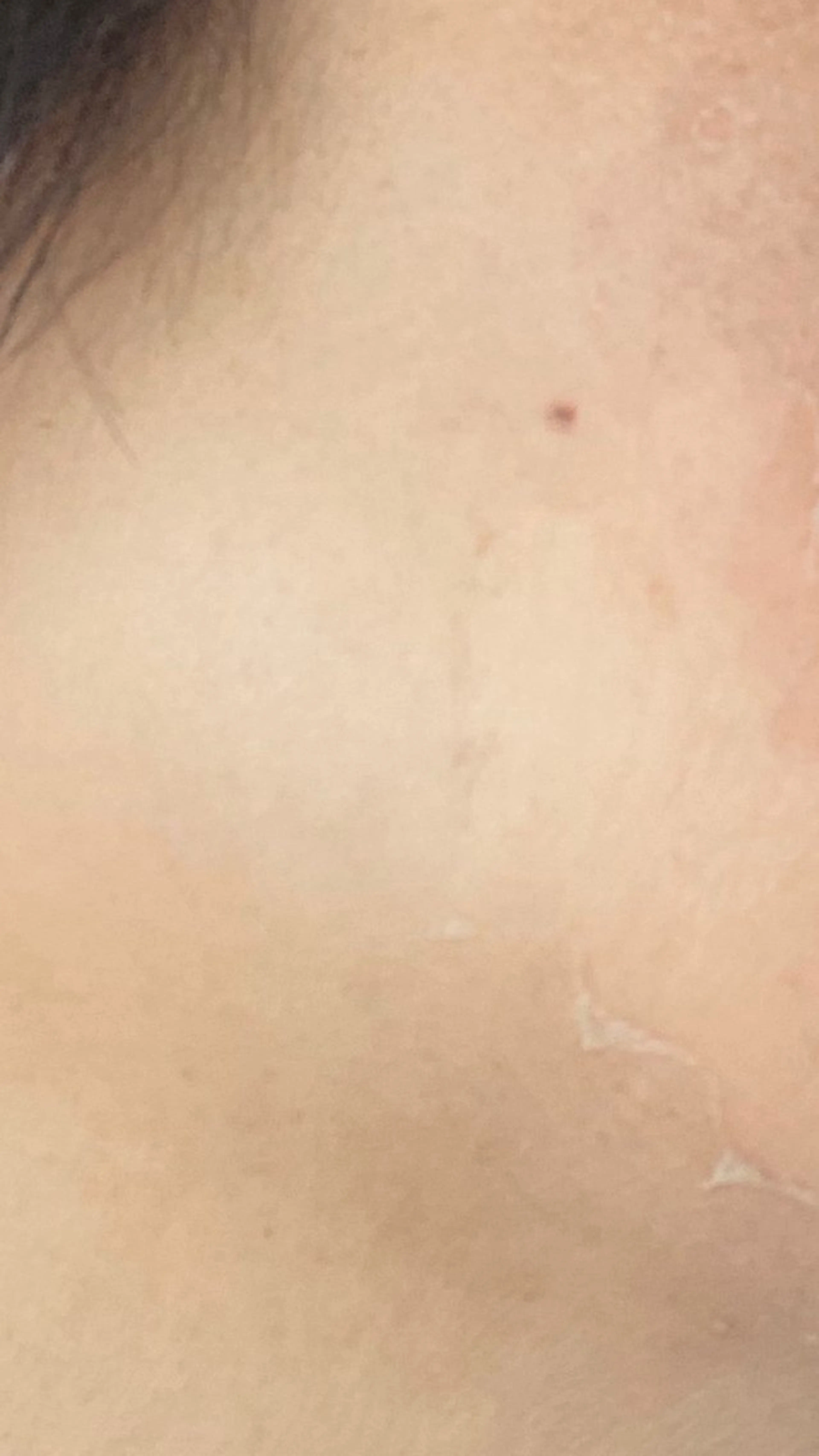 brilliance所属・老化肌トラブル肌専門 Brillianceのエステ・リラクイメージ