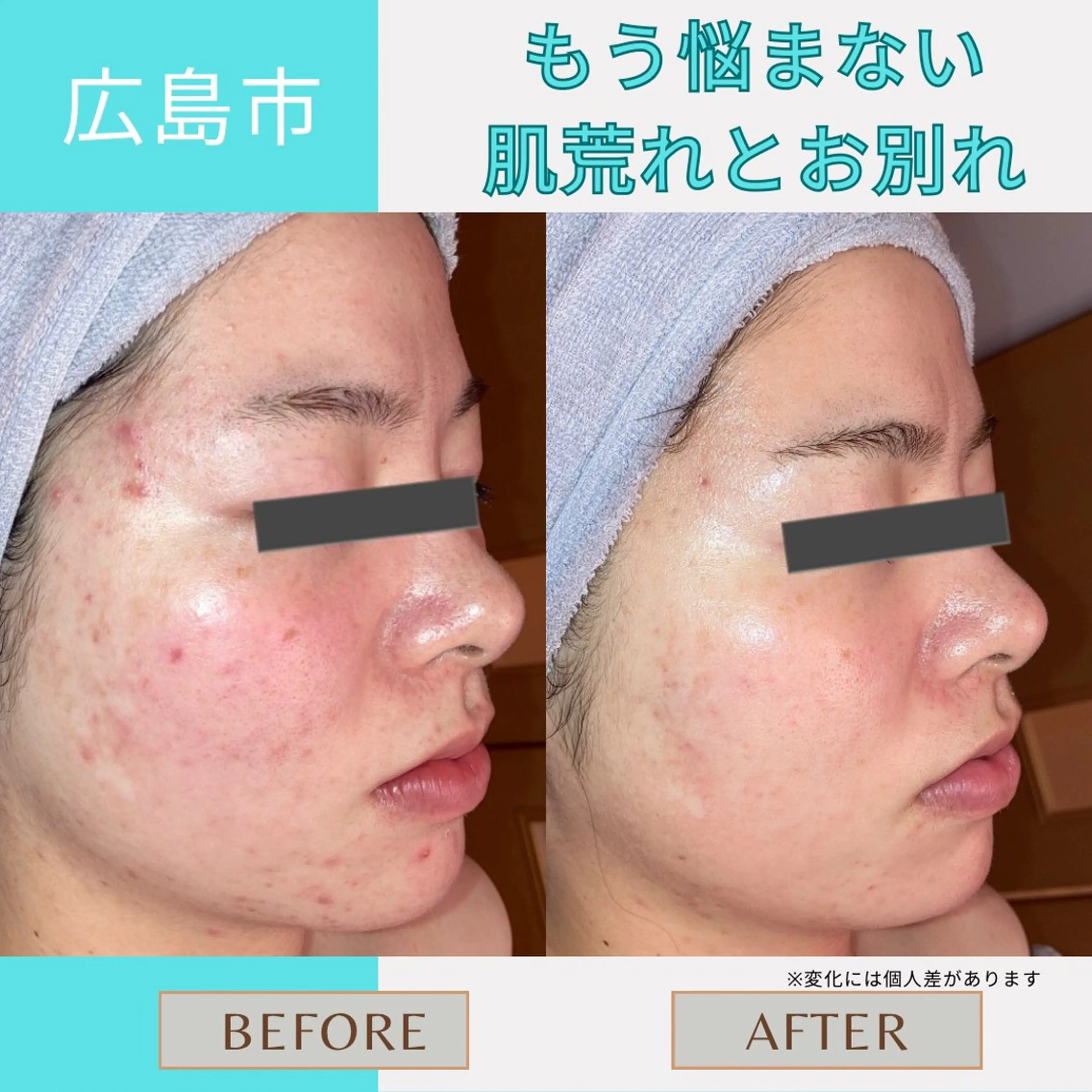 Le・Ciel フェイシャル&ボディのエステ・リラクイメージ