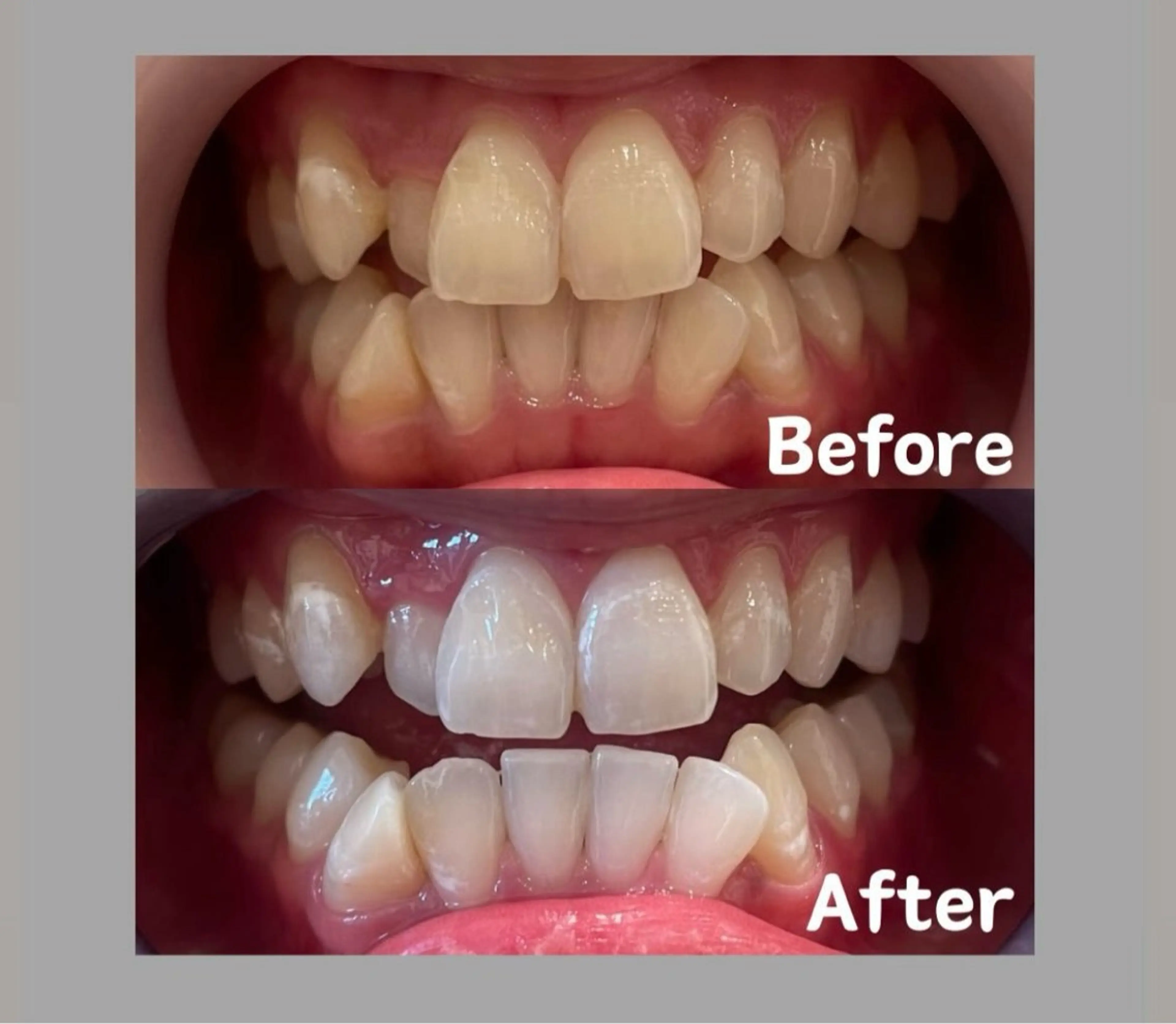 Kaula ホワイトニング🦷✨のエステ・リラクイメージ