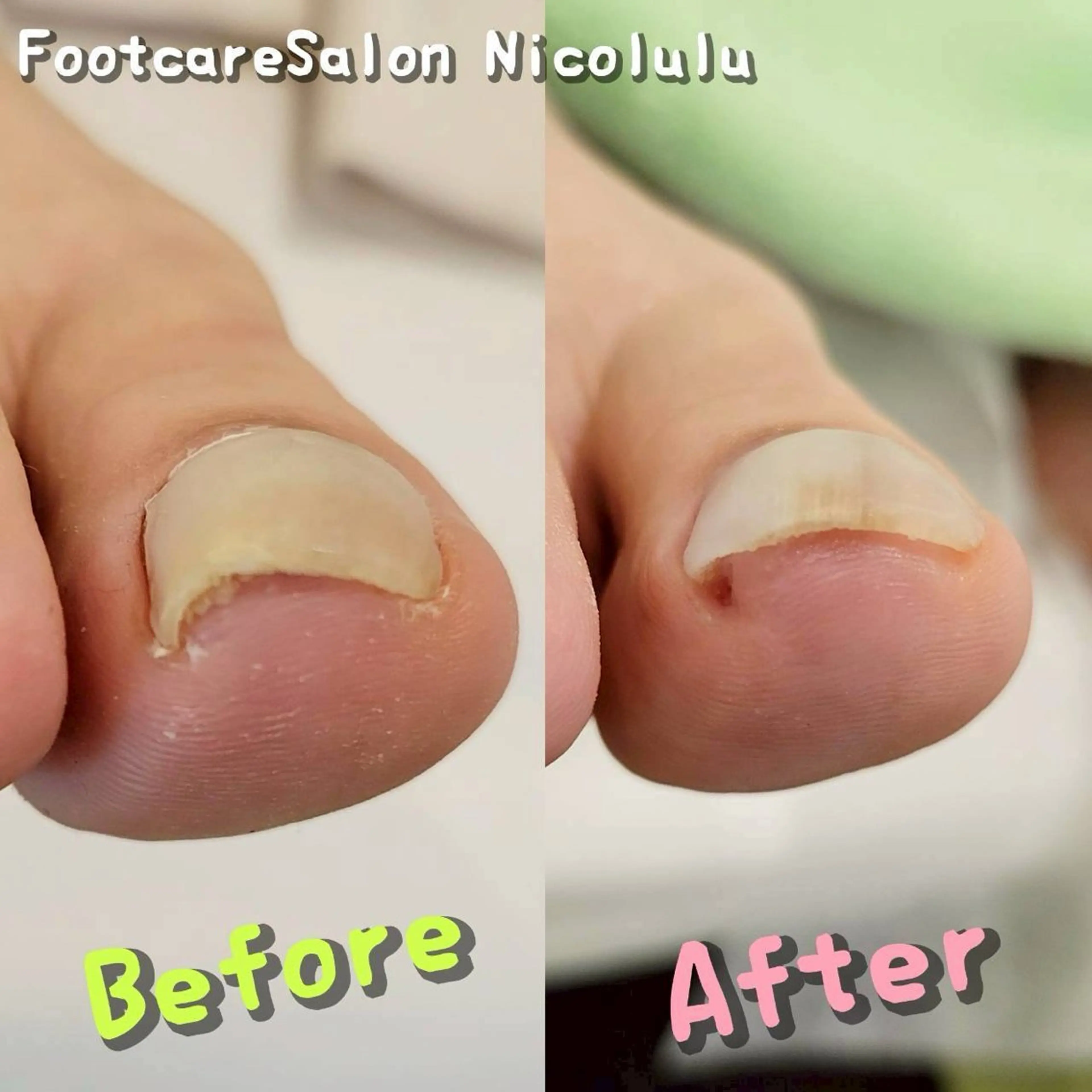 リラク 足トラブル専門 ニコルル金沢のエステ・リラクイメージ