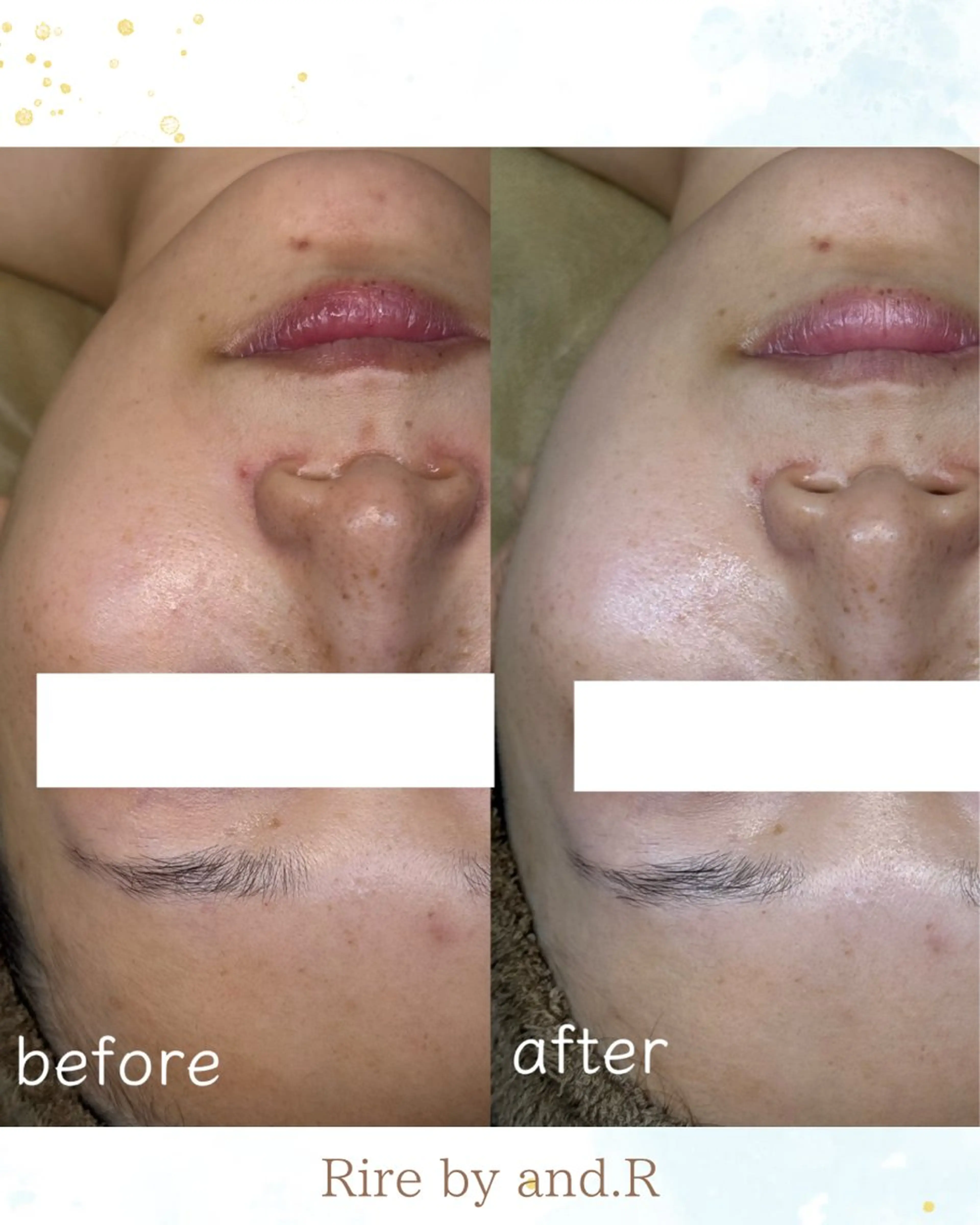 エステ 長野 美里のエステ・リラクイメージ