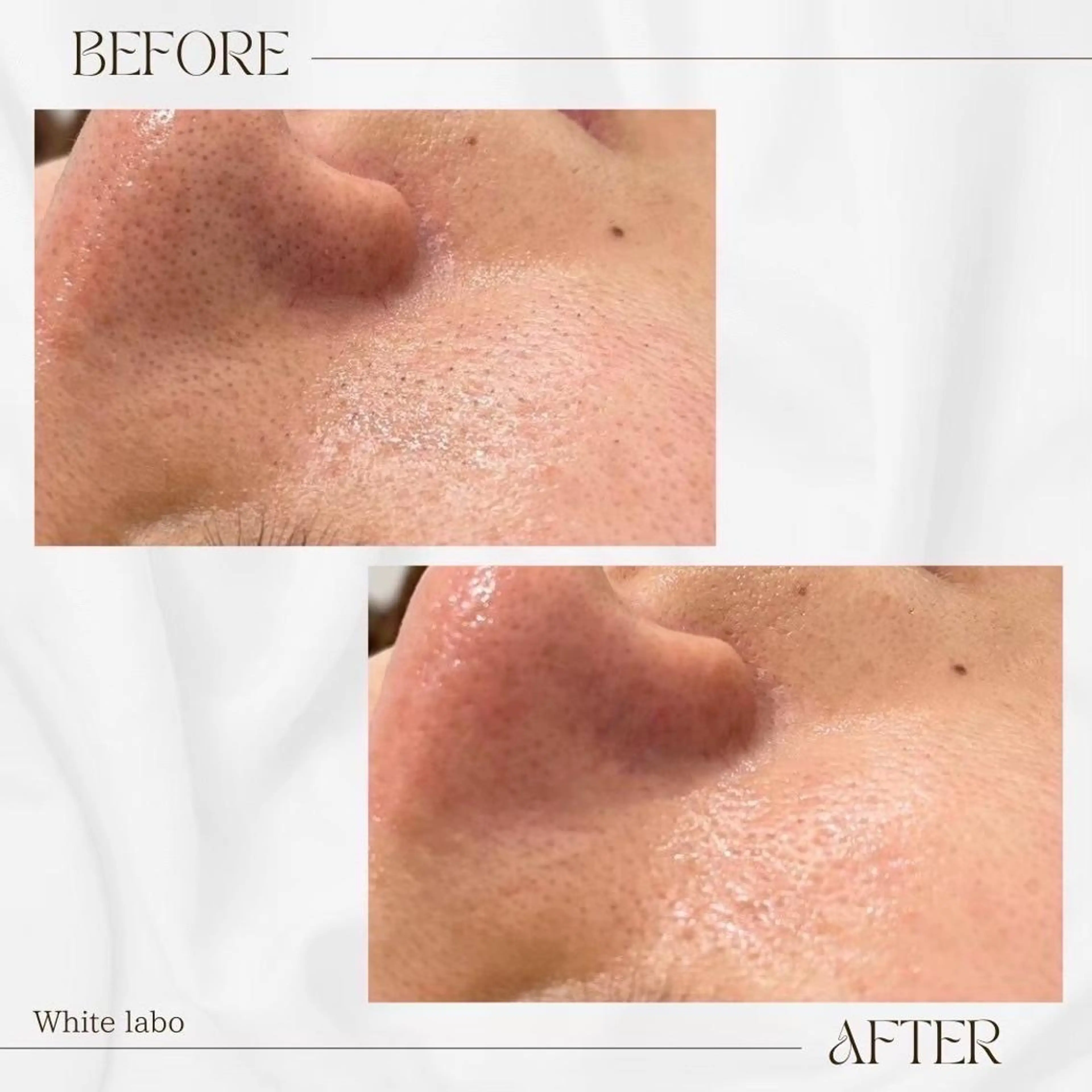 White labo 今村のエステ・リラクイメージ