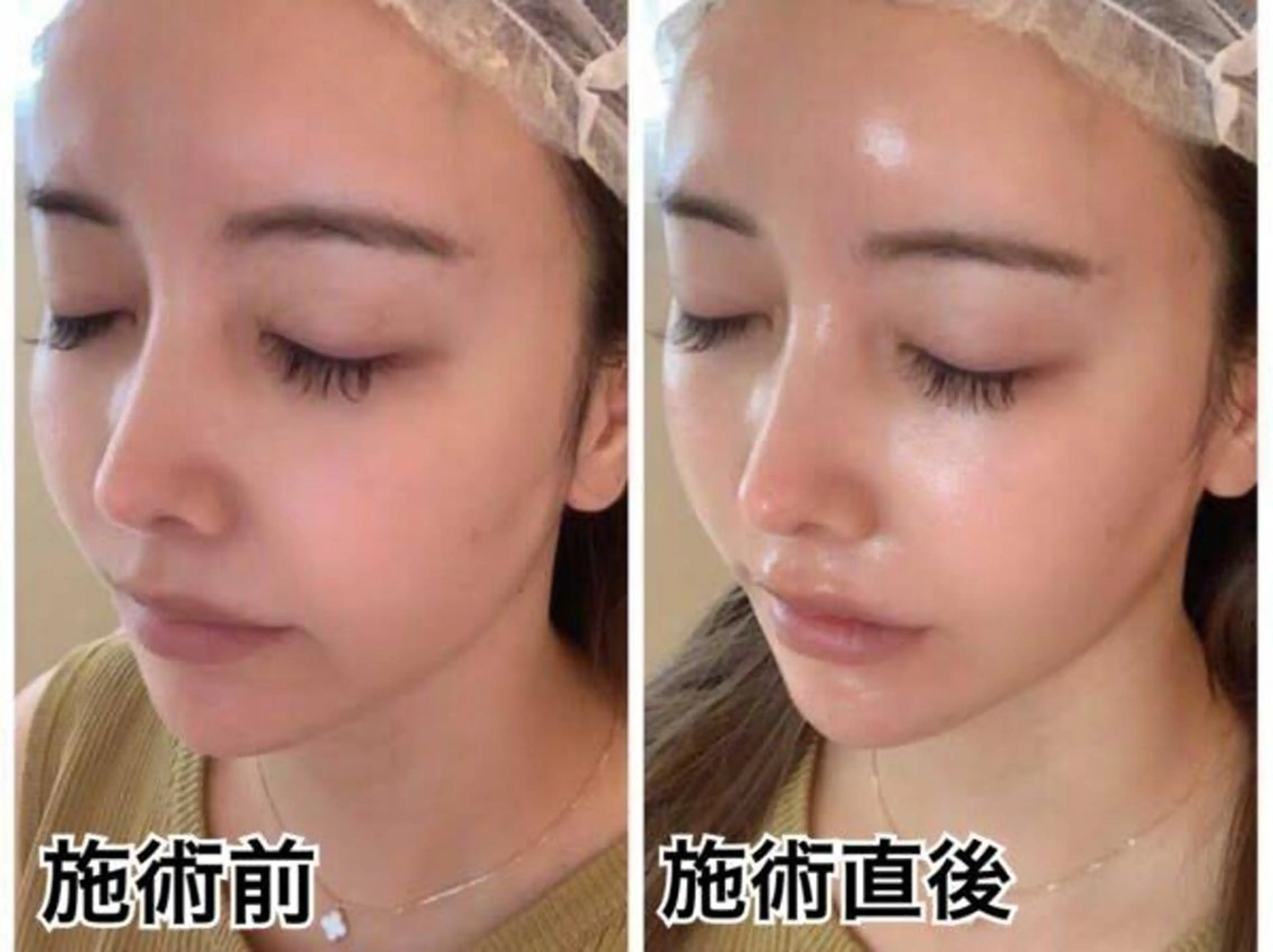 エステ BestBelleꕤ 大阪福島/肌質改善のエステ・リラクイメージ