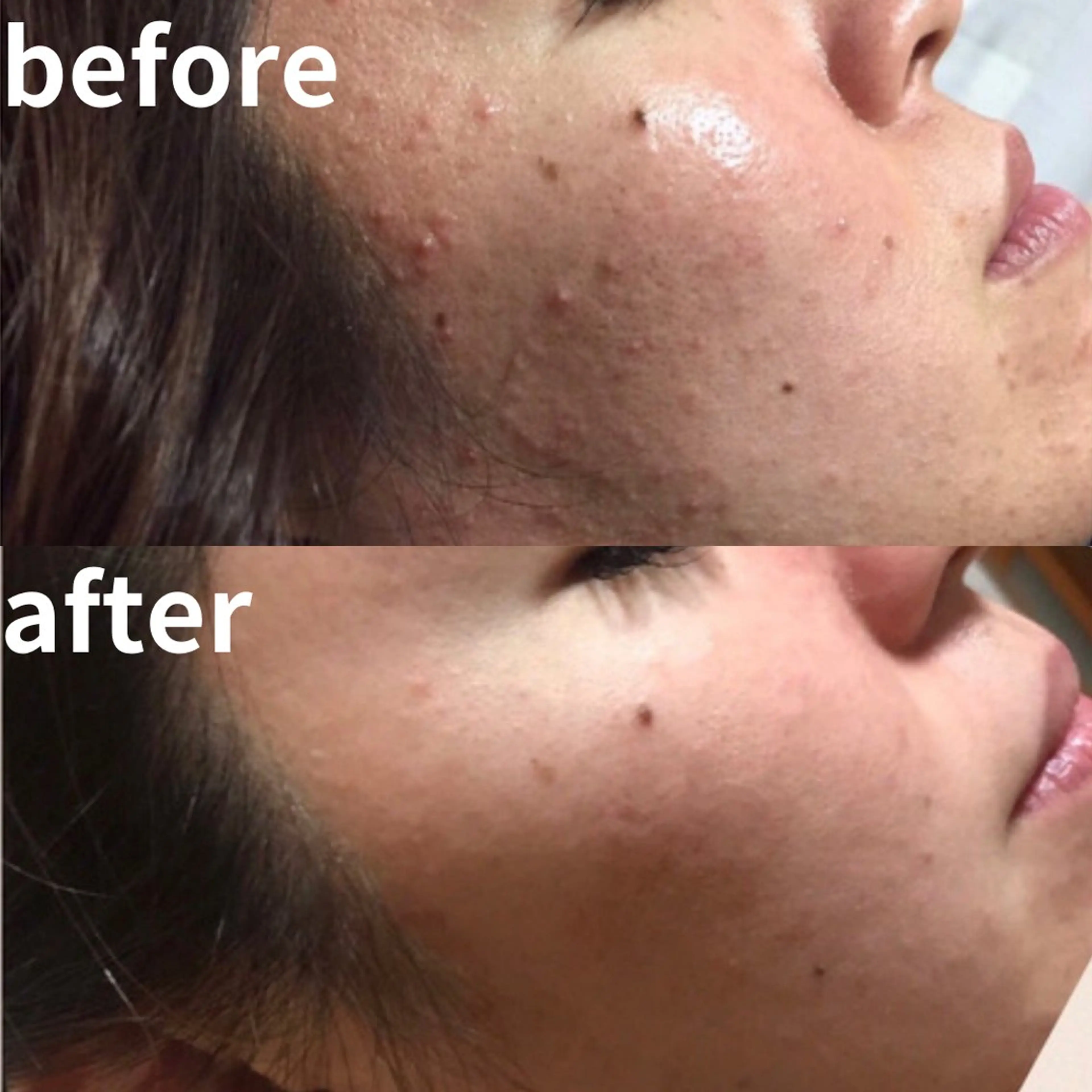 エステ リラク 痩せるハーブ蒸し／ 温活サロン imuaのエステ・リラクイメージ