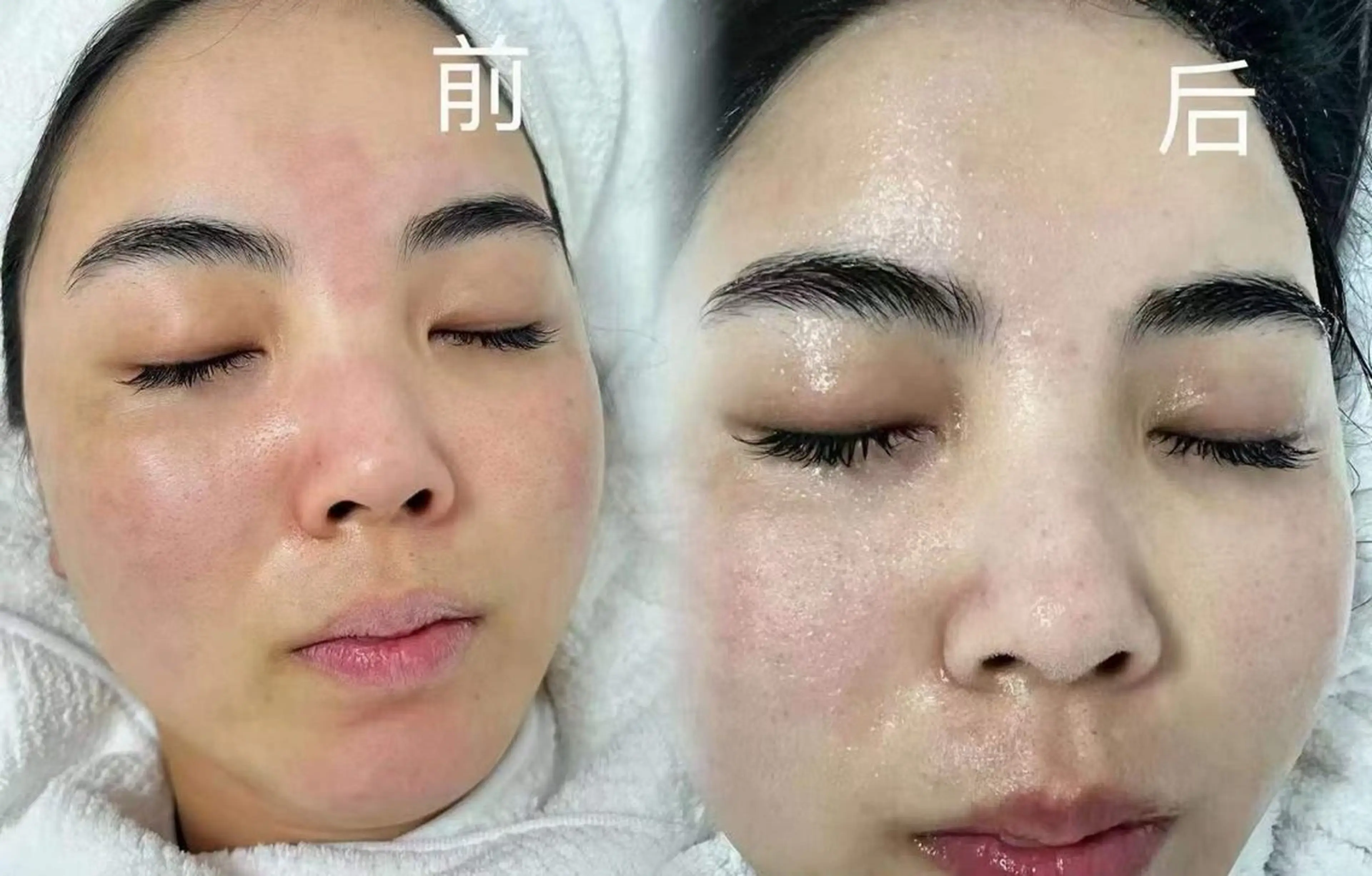 ネイル エステ aliaハイフ&水光ジェットサロン所属・aliaハーブ水光店 エステティシャン募集のエステ・リラクイメージ