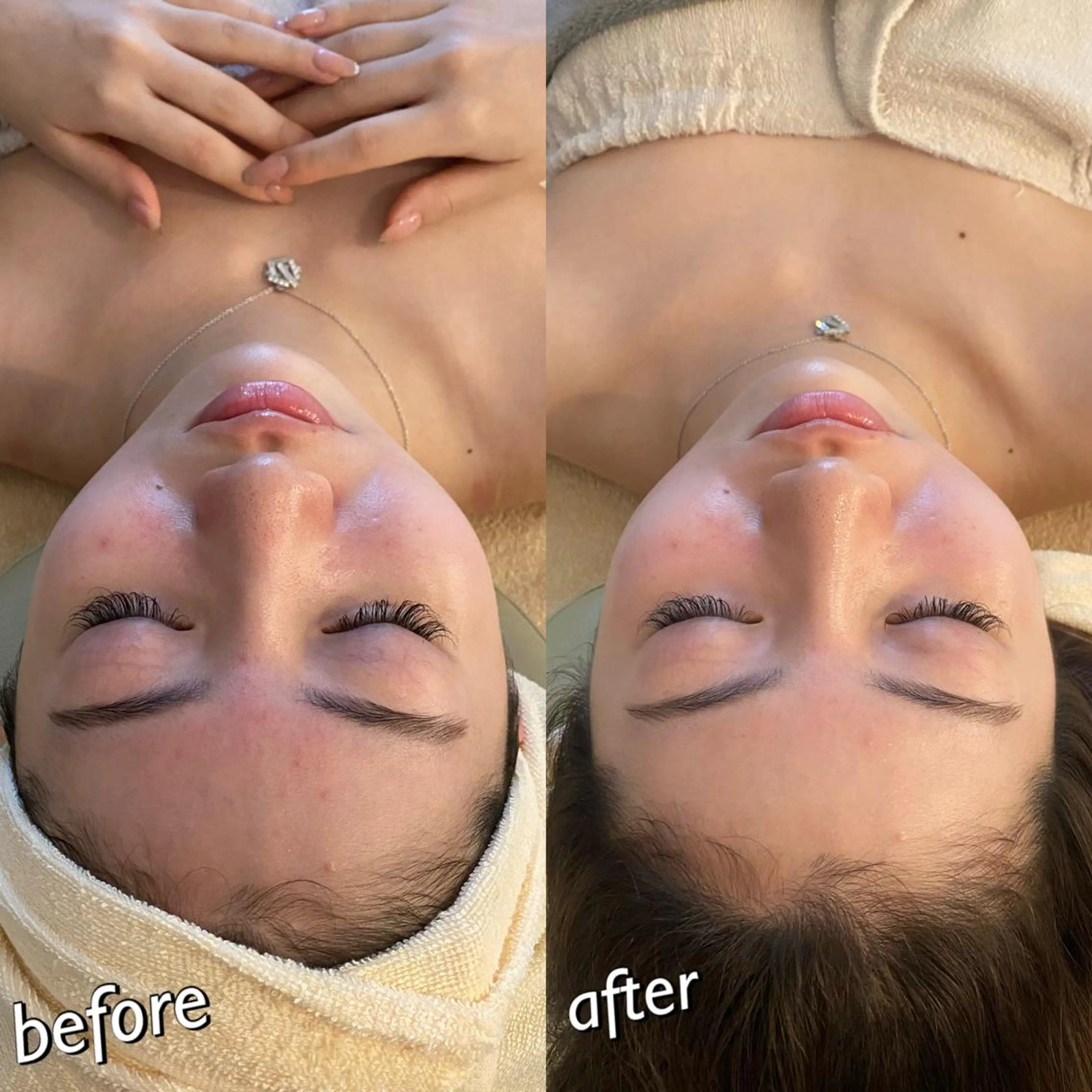 うなじ脱毛/美肌脱毛 LABELのエステ・リラクイメージ