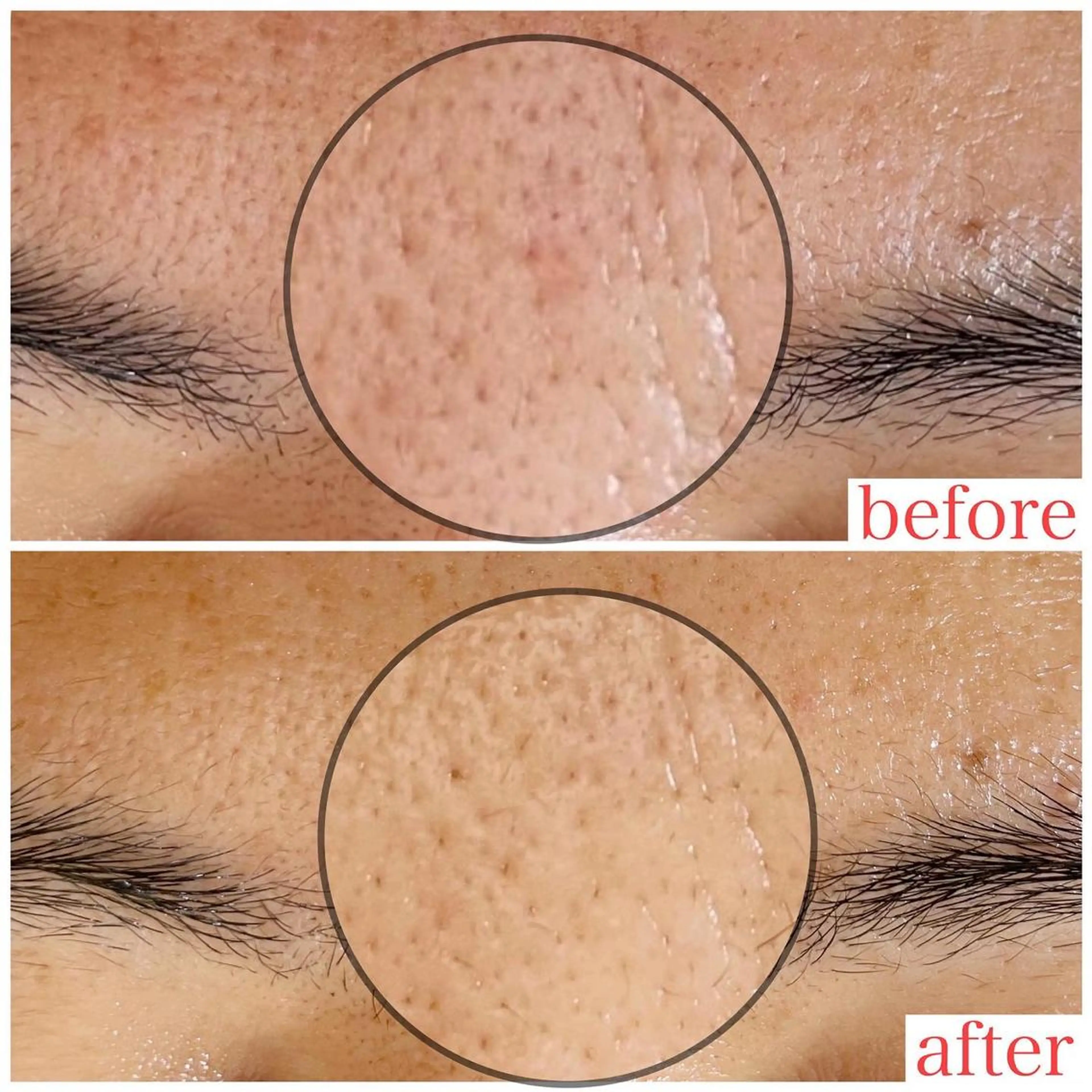 エステ 毛穴ケア専門サロン レーヌのエステ・リラクイメージ