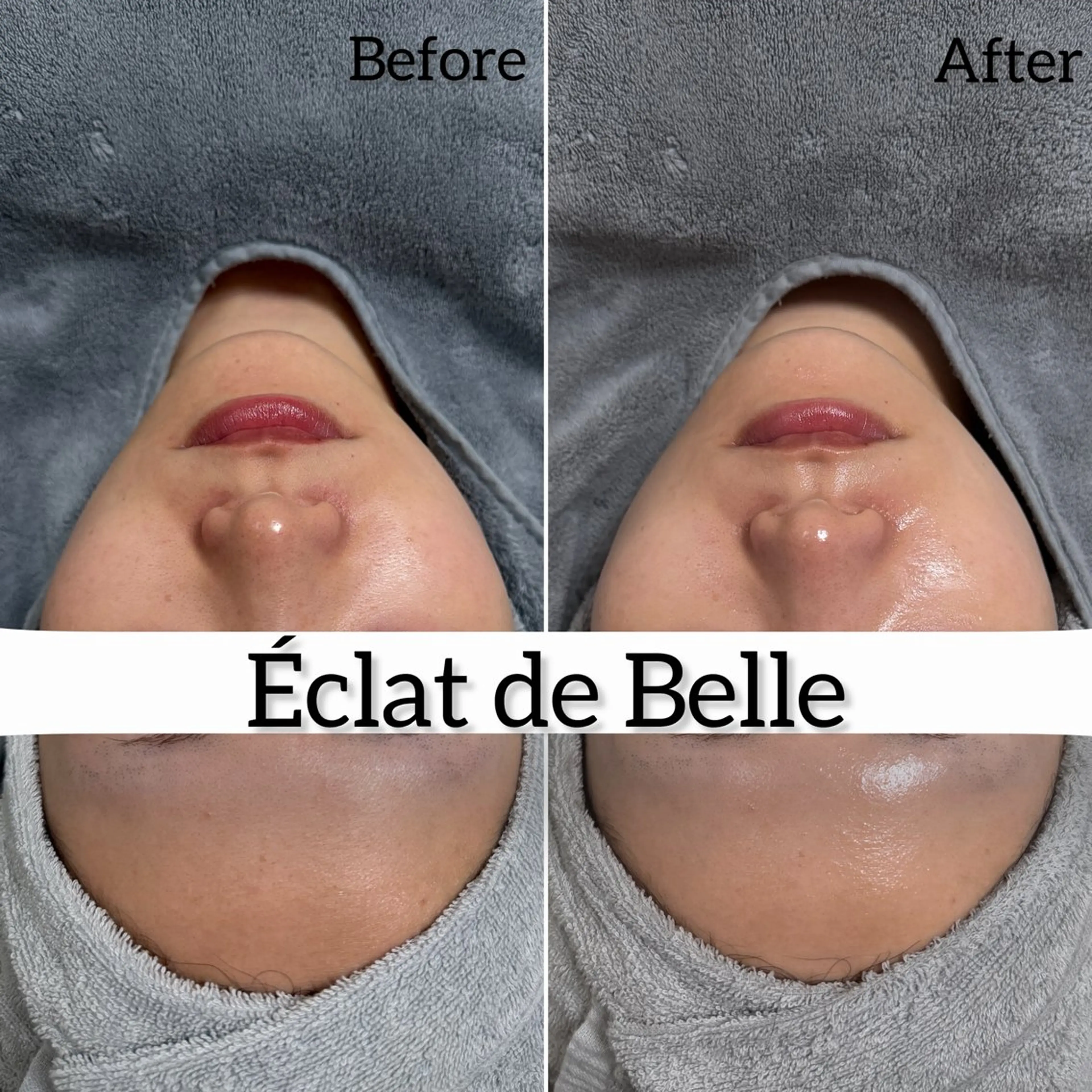 その他 Éclat de Belle🫧白玉肌のその他イメージ