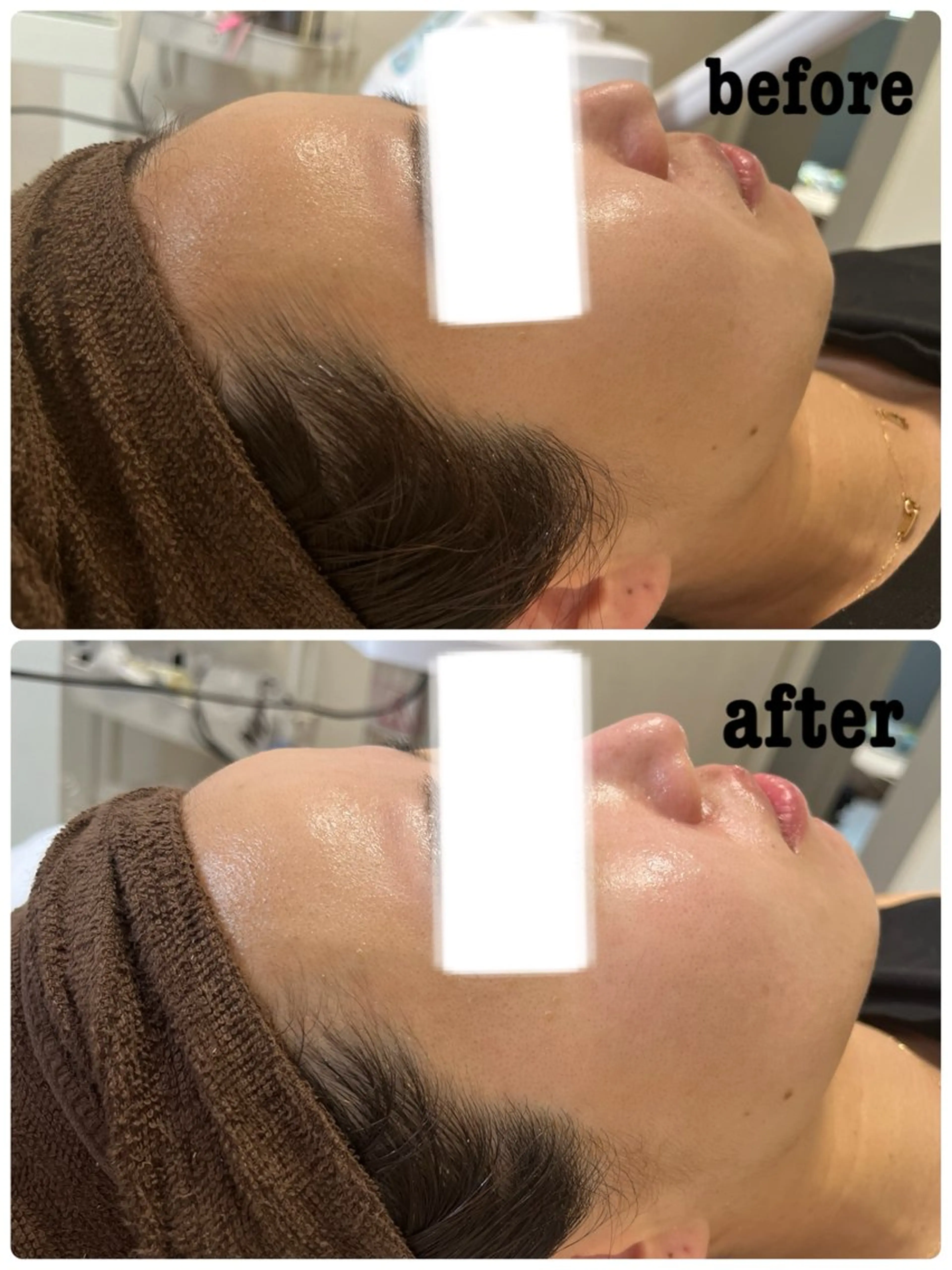 エステ SALON MAREのネイルデザイン