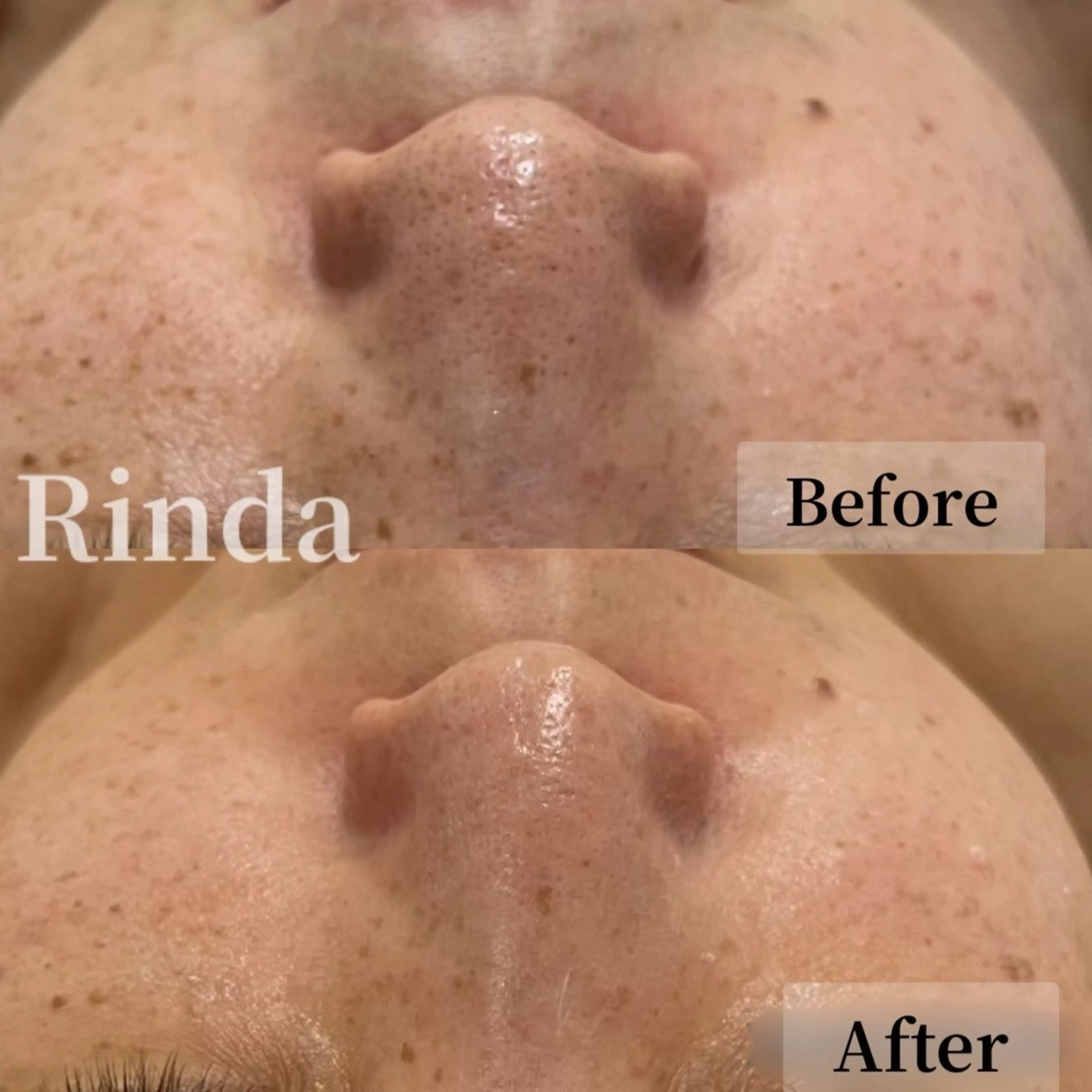 エステ ブライダル痩身×脱毛 尼崎駅前サロンのエステ・リラクイメージ