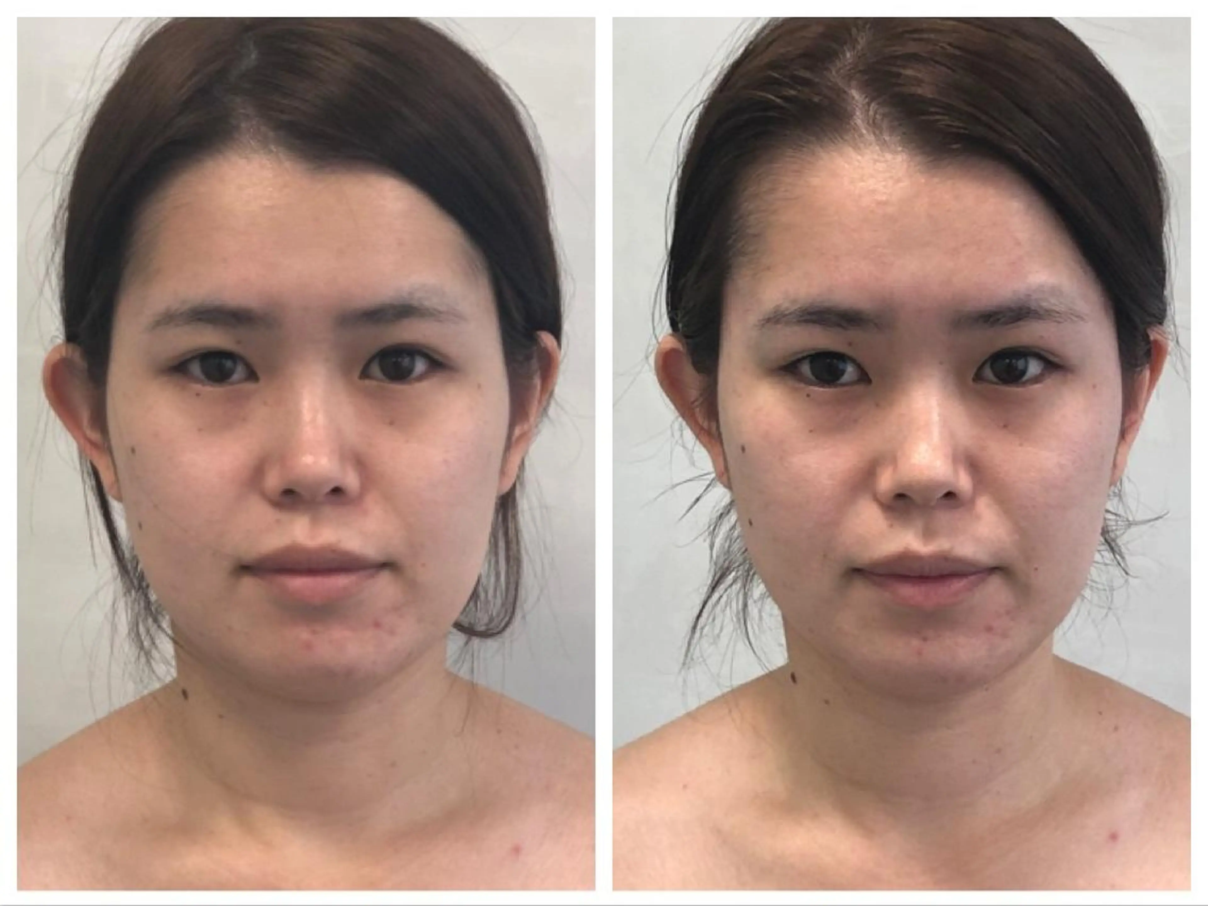 ブランフルレット 麻布十番エステサロンのエステ・リラクイメージ