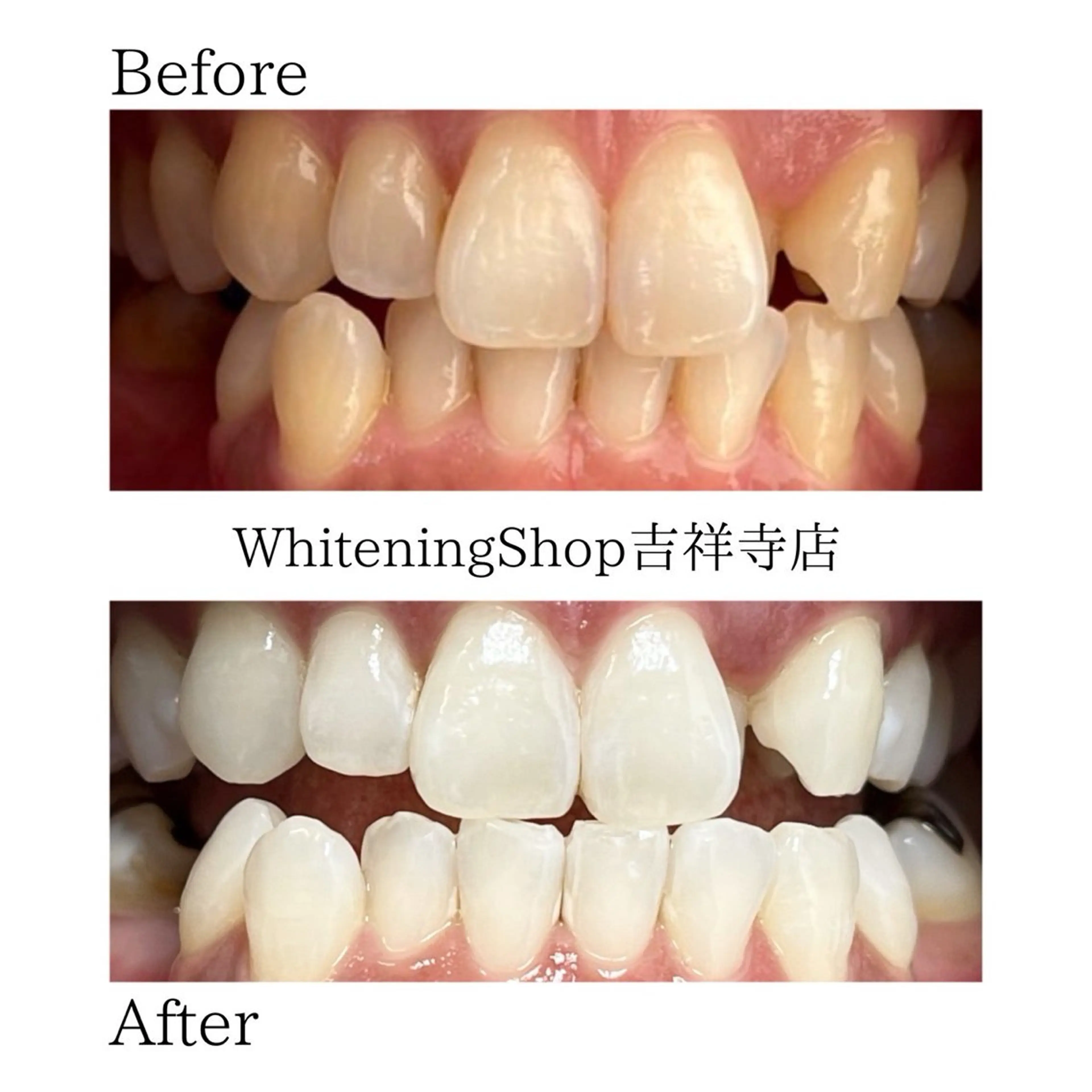 エステ リラク ホワイトニング ショップ吉祥寺店のエステ・リラクイメージ