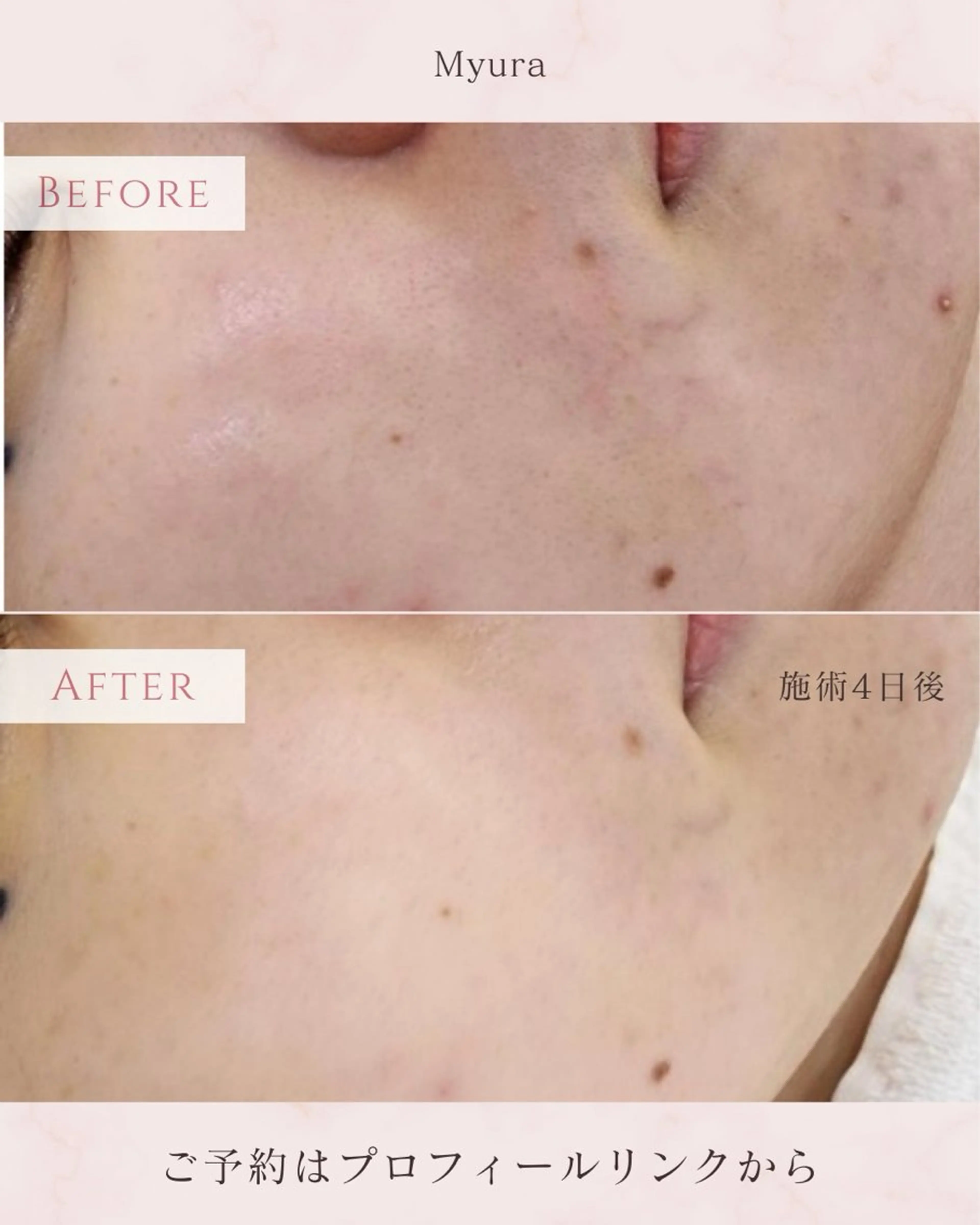 Myuraオーナー MIYUのエステ・リラクイメージ