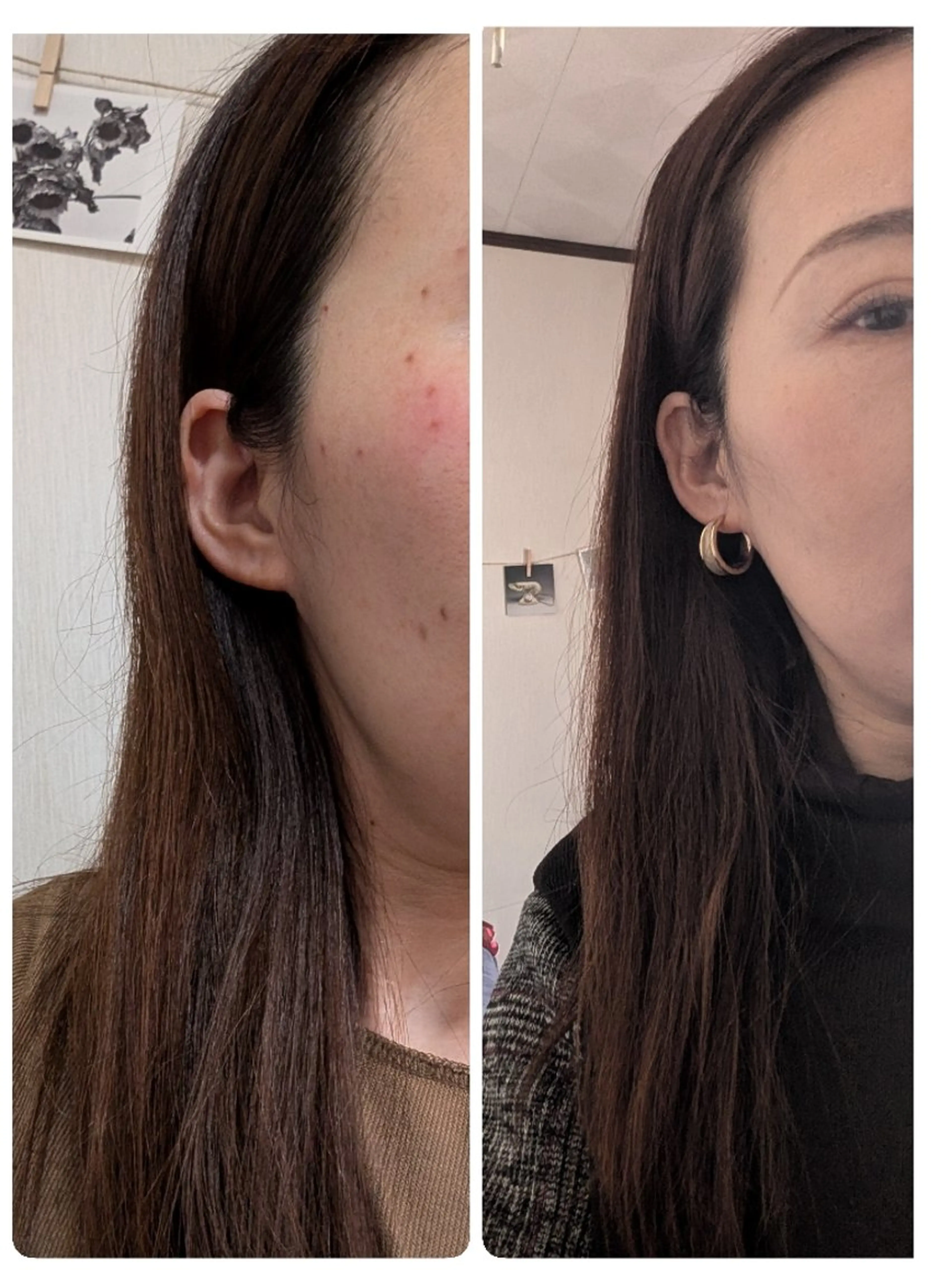 SPOT.com  シミケア専門店のエステ・リラクイメージ