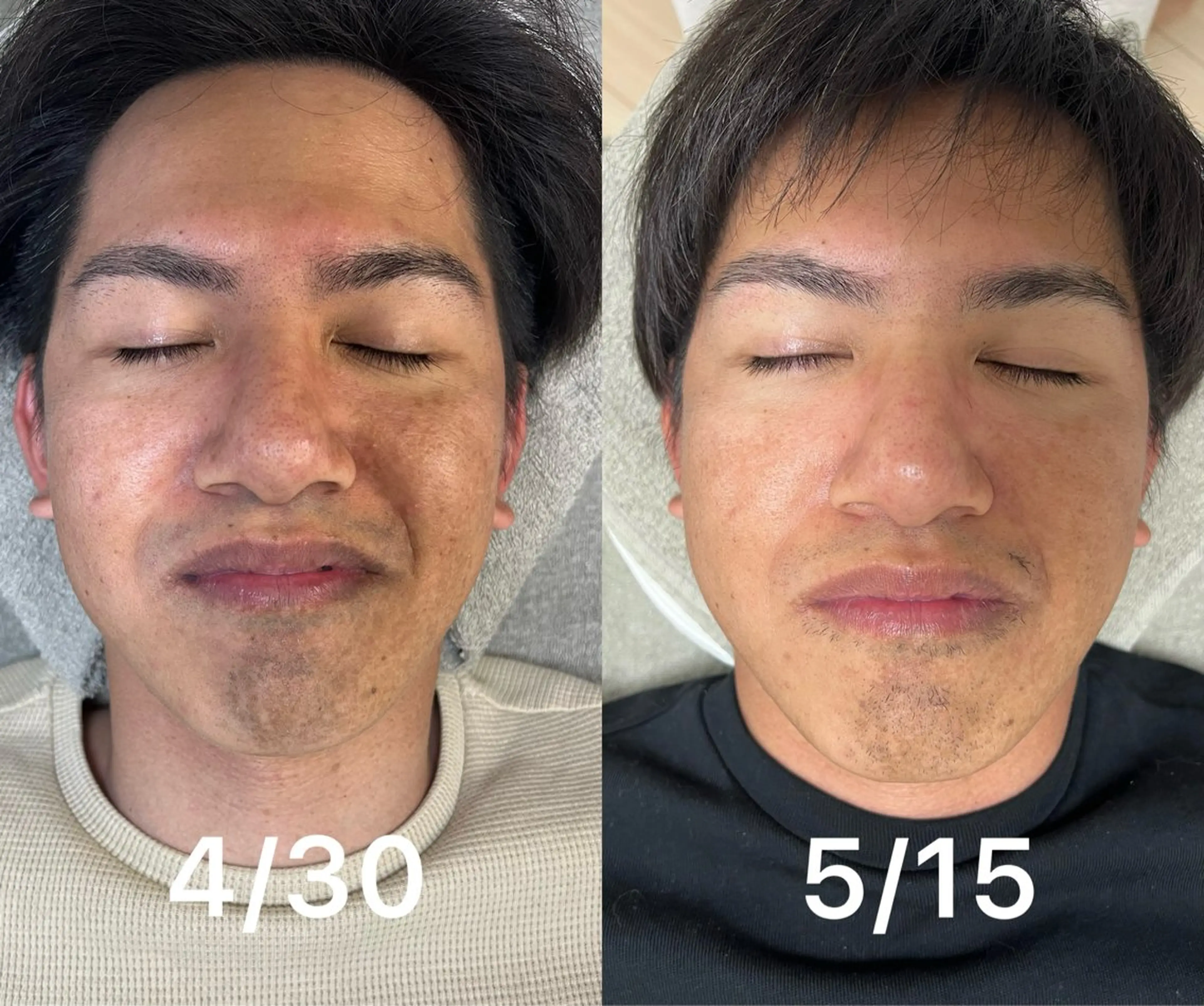 メンズ Akala miのエステ・リラクイメージ