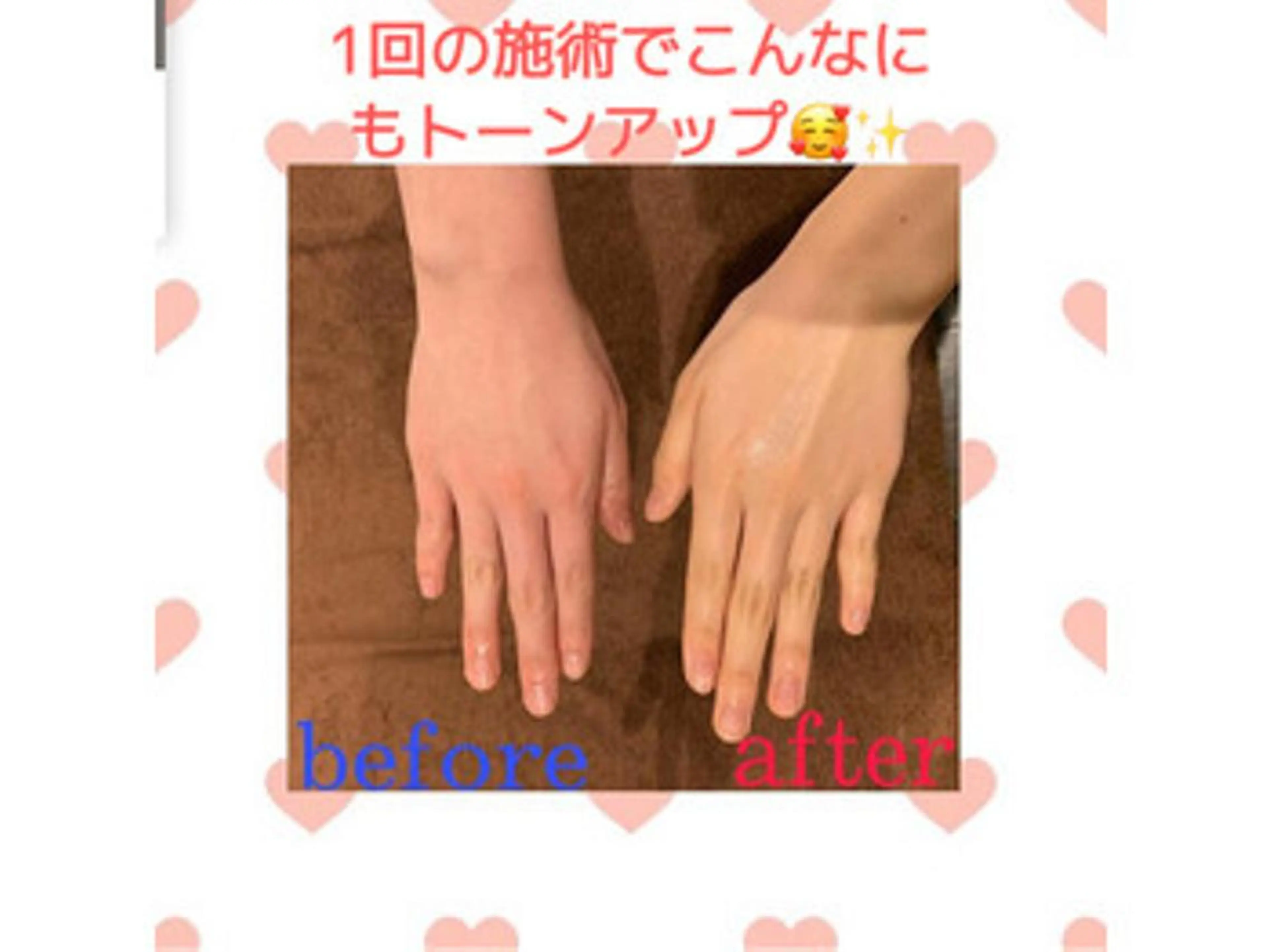 キッズ 美肌脱毛専門店 ディオーネ四日市店のエステ・リラクイメージ