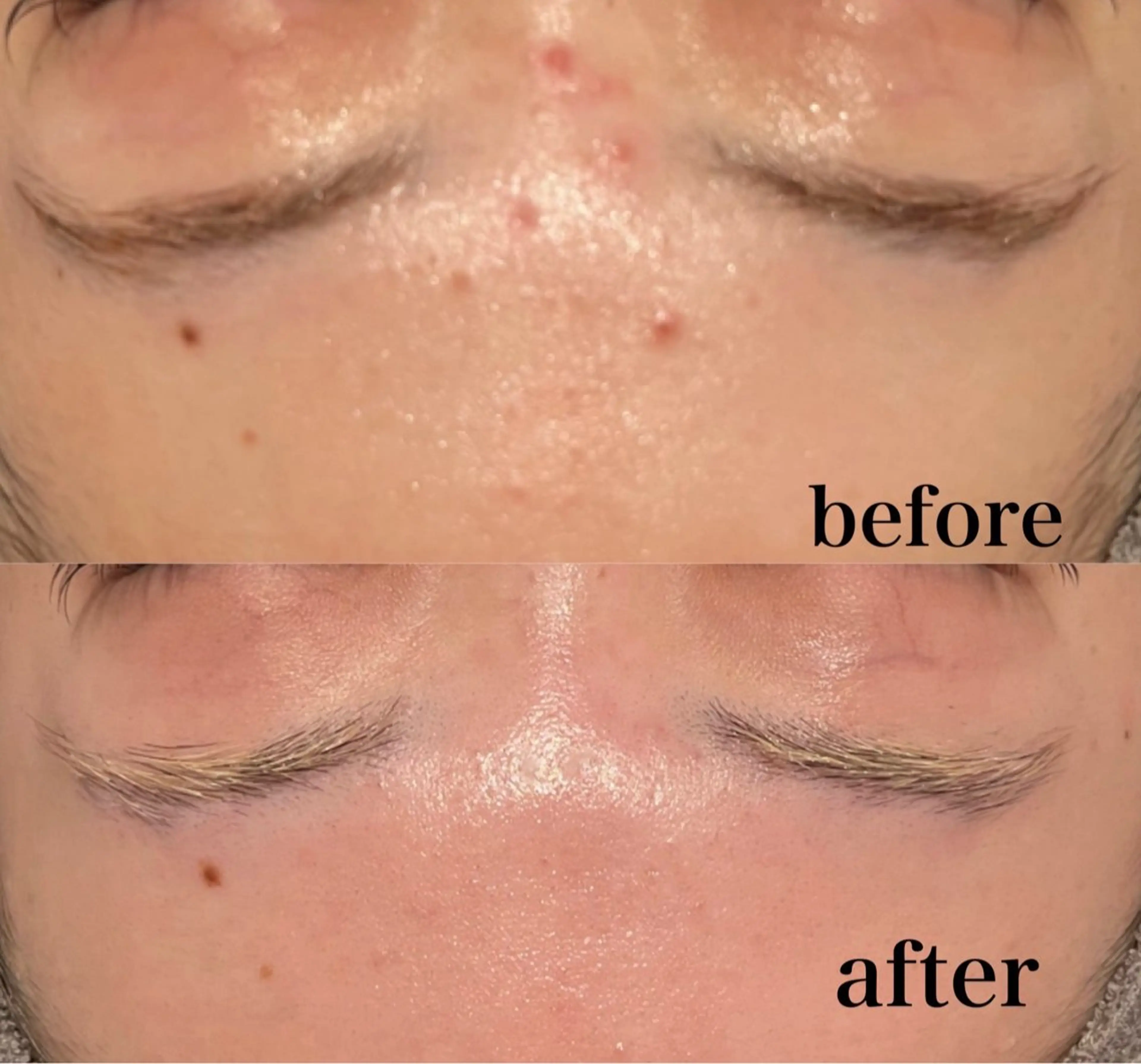 Butterfly 平塚店　佐藤のエステ・リラクイメージ