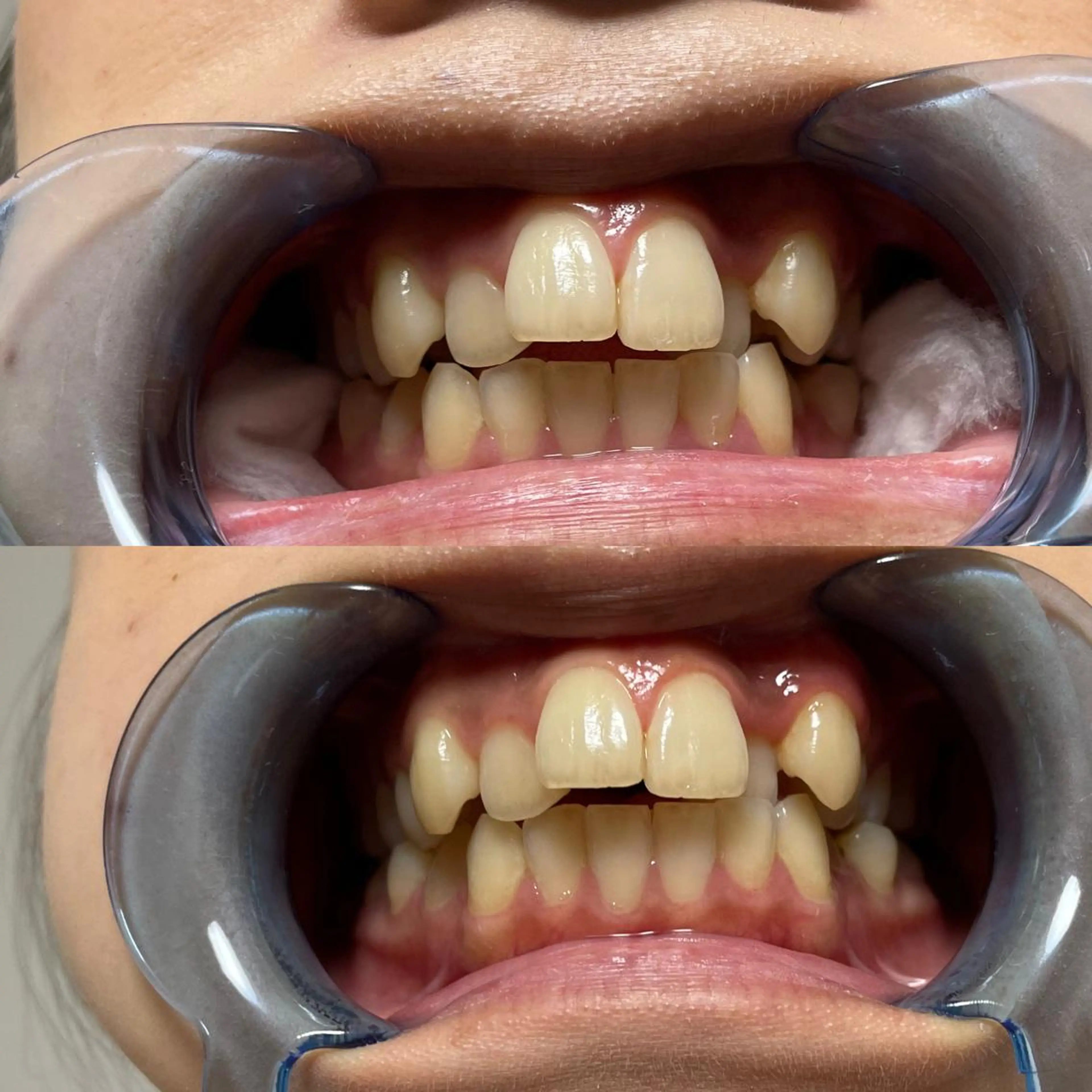 西宮ホワイトニング Kirarie所属・志水 有美のエステ・リラクイメージ