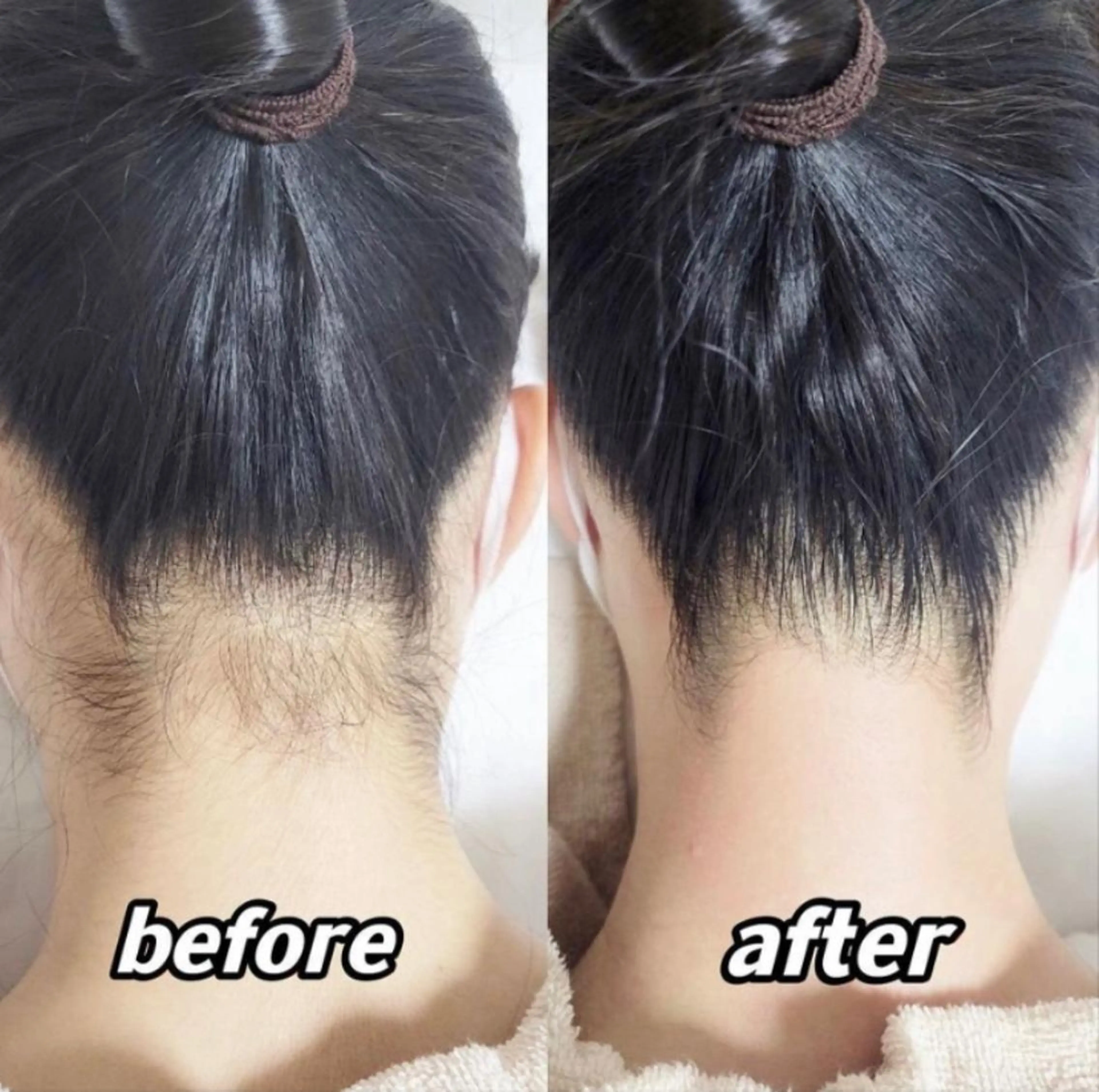 脱毛 【A*エースター】 KARINのエステ・リラクイメージ