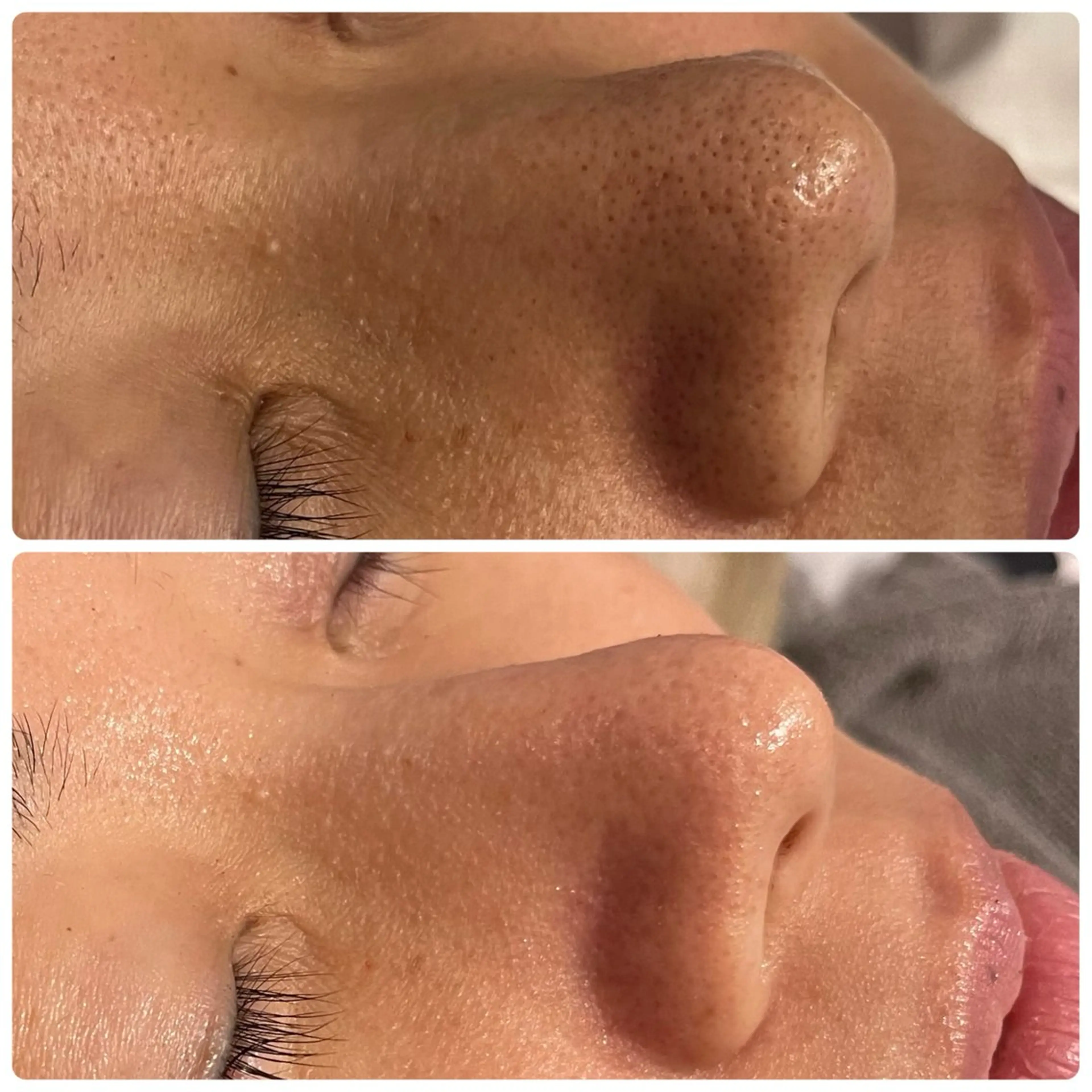 その他 yellow.所属・yellow💛【 脱毛&フェイシャル】のエステ・リラクイメージ