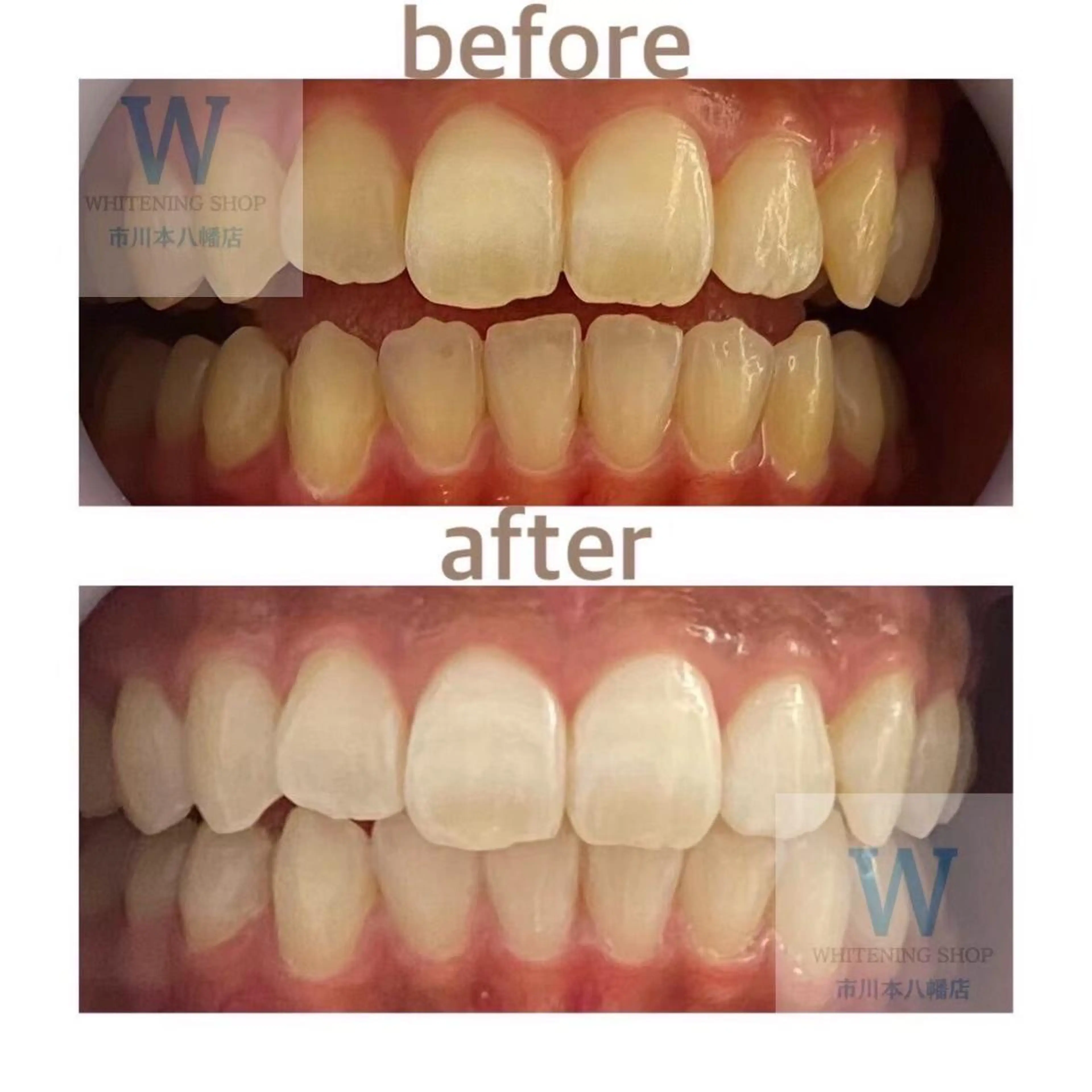 ホワイトニング ショップ本八幡店のエステ・リラクイメージ