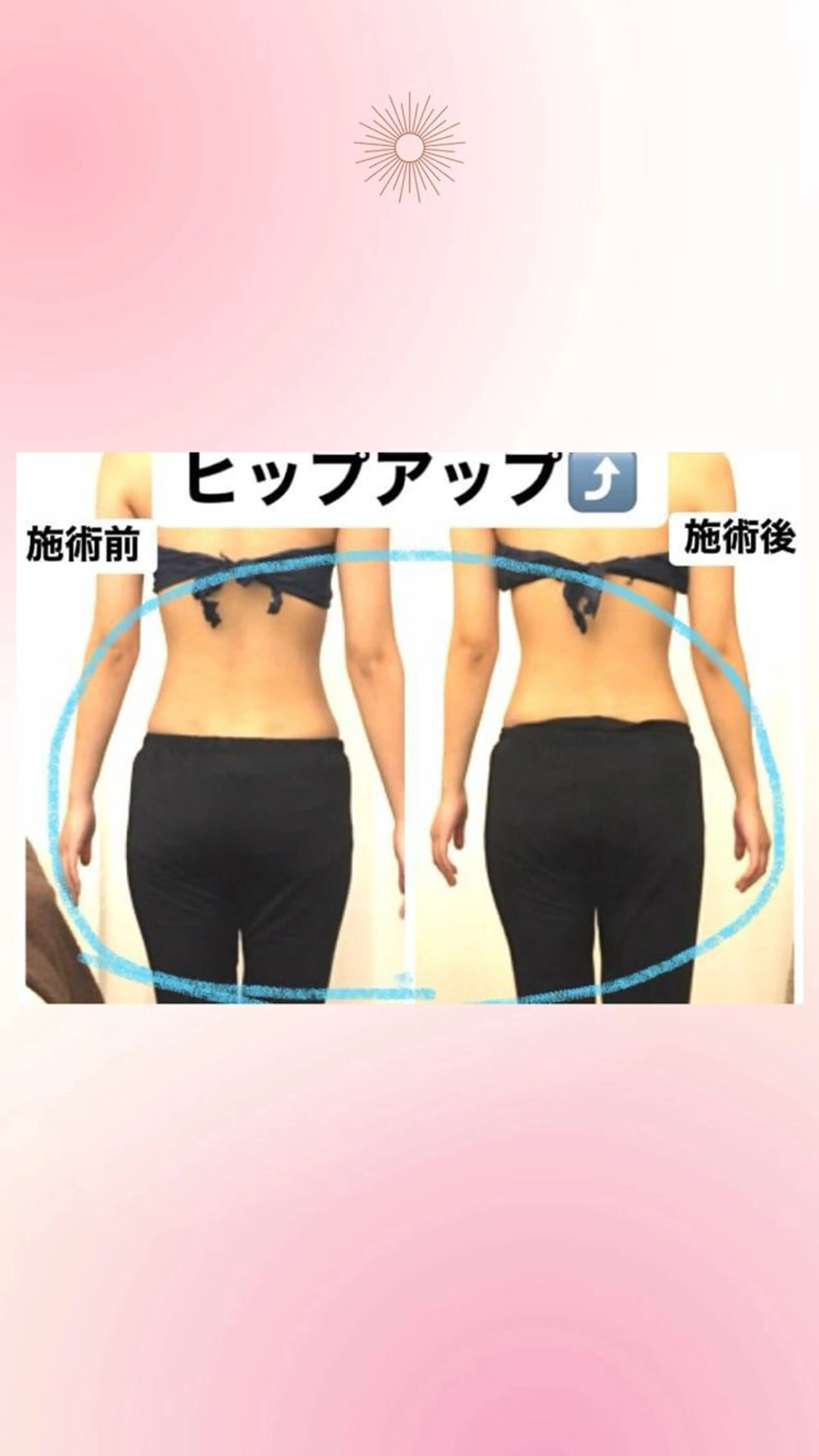 エステ 骨格美セラピーfuwari所属・fuwariオーナー じゅんこのエステ・リラクイメージ