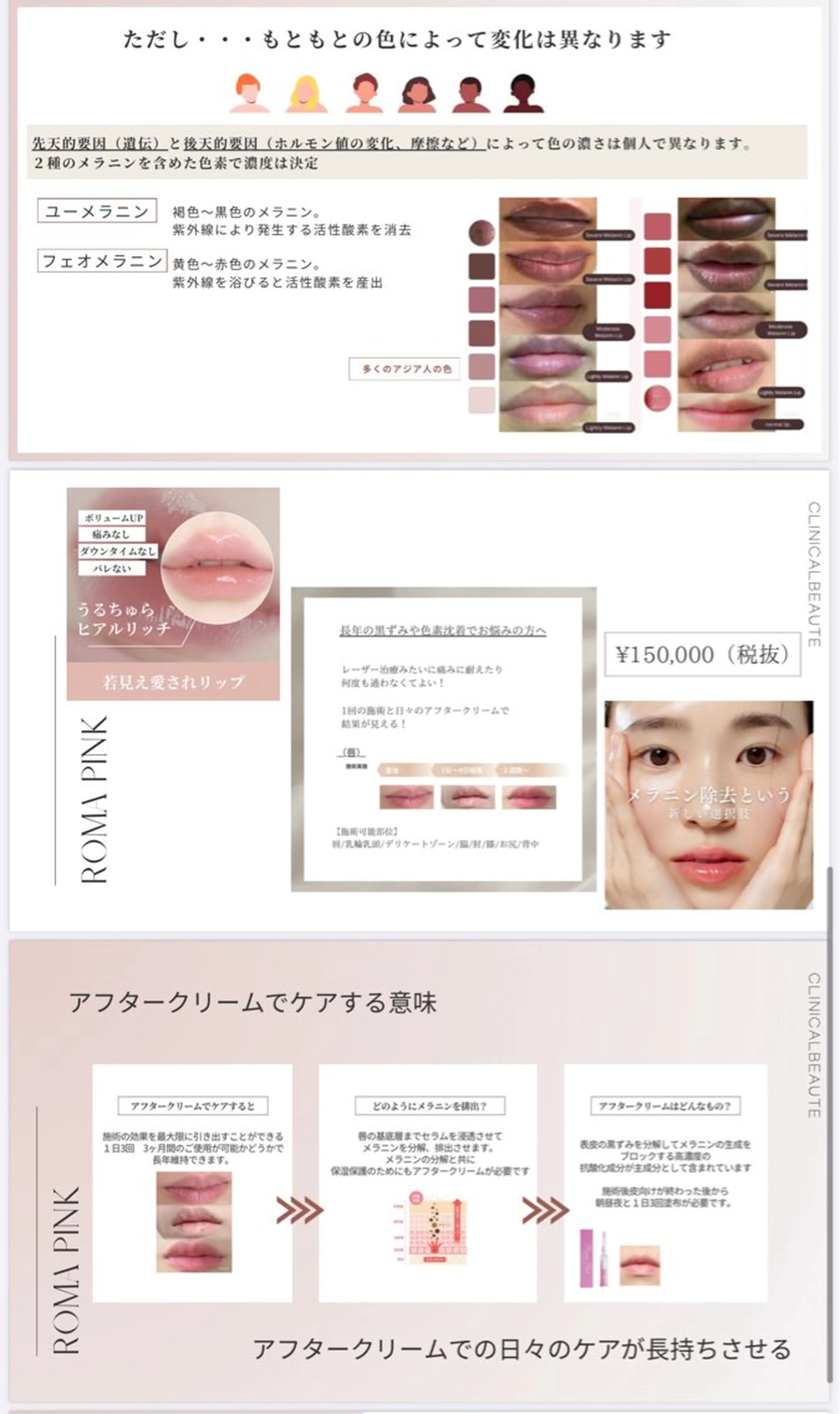 エステ 女性のお悩み美容 サロン　ヴィーナスのエステ・リラクイメージ