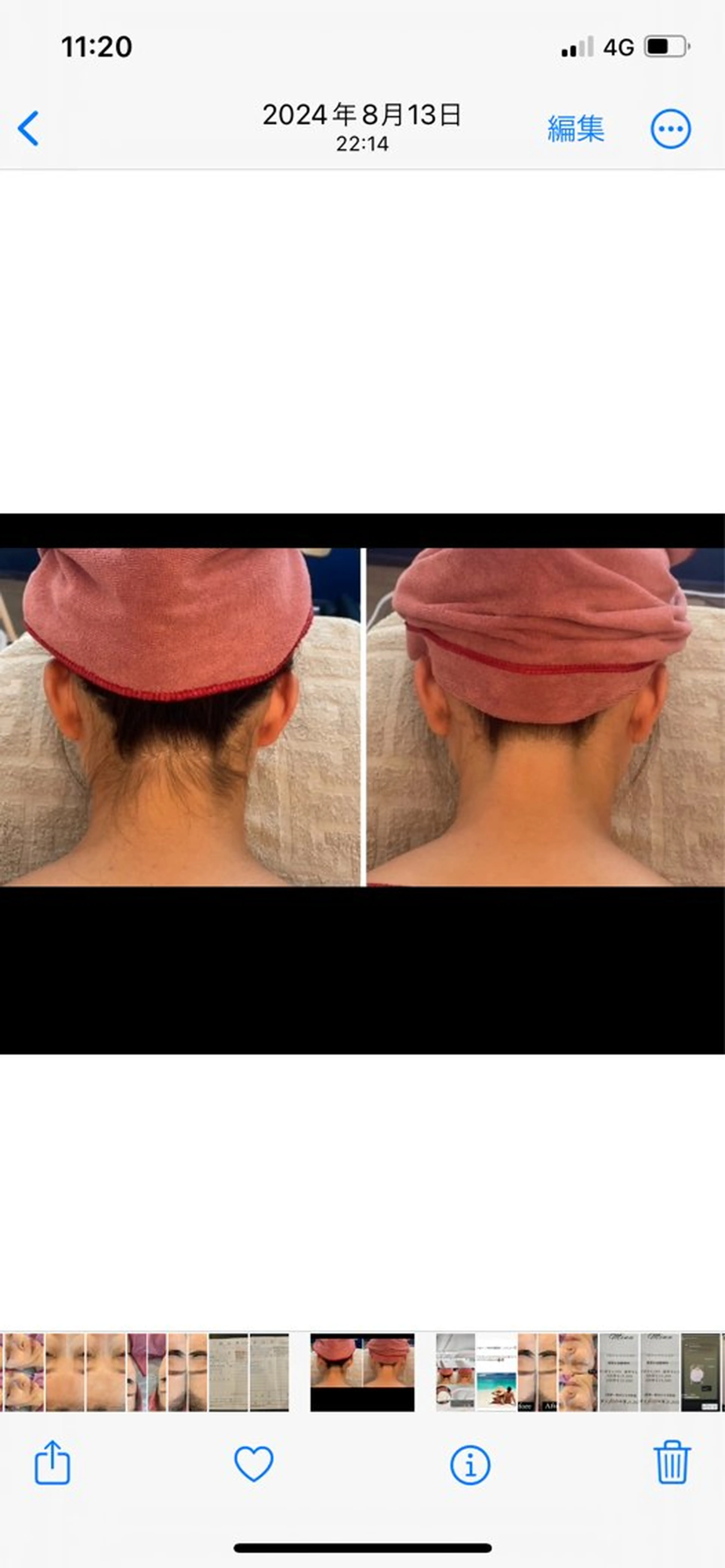 半田市エステサロン　シェソワ所属・ニキビ/疲労回復ケア シェソワのエステ・リラクイメージ